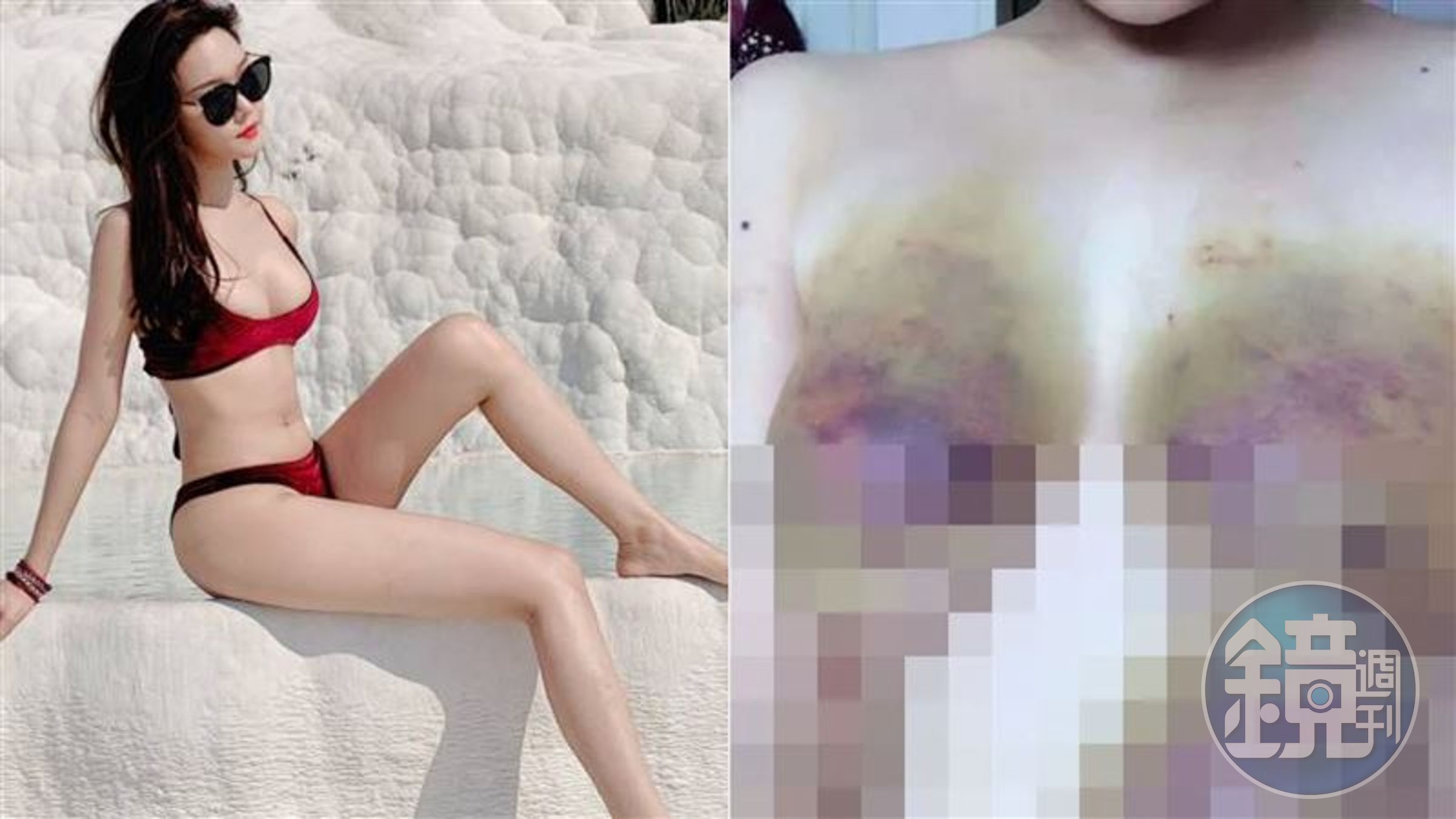 百萬網紅「雅典娜liya」傳被詐騙到東南亞,且流傳一組被毆打的慘照。(翻攝自微博)