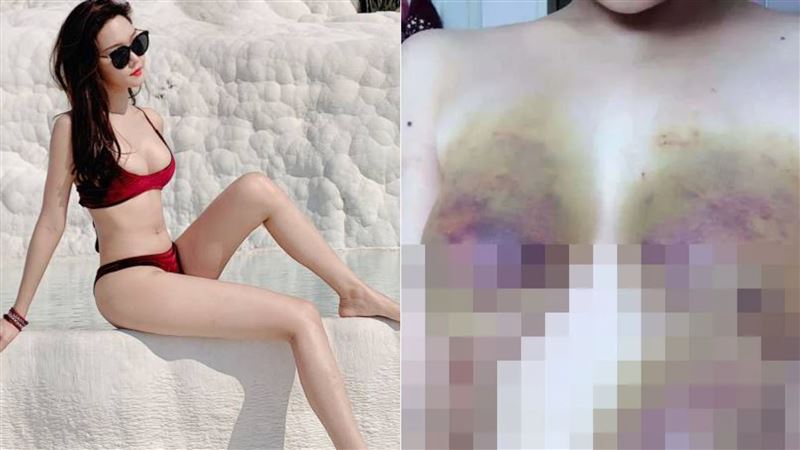 百萬網紅「雅典娜liya」傳被詐騙到東南亞,且流傳一組被毆打的慘照。(翻攝自微博)