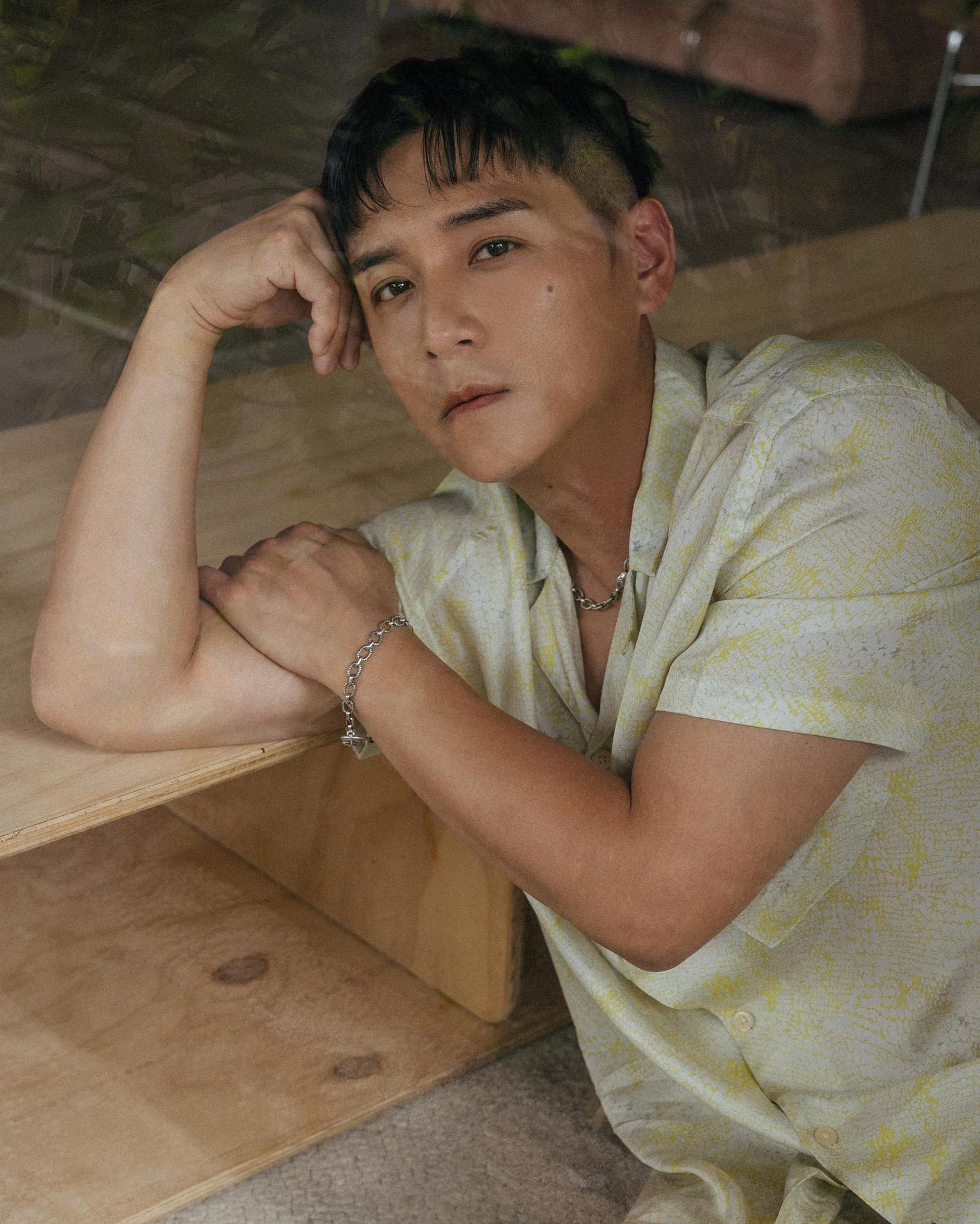 戲約不斷的鄭人碩因右臉受傷，為了不耽誤即將殺青的新戲，他避開右臉以左臉入鏡，技術性完成拍攝。（翻攝自鄭人碩臉書）