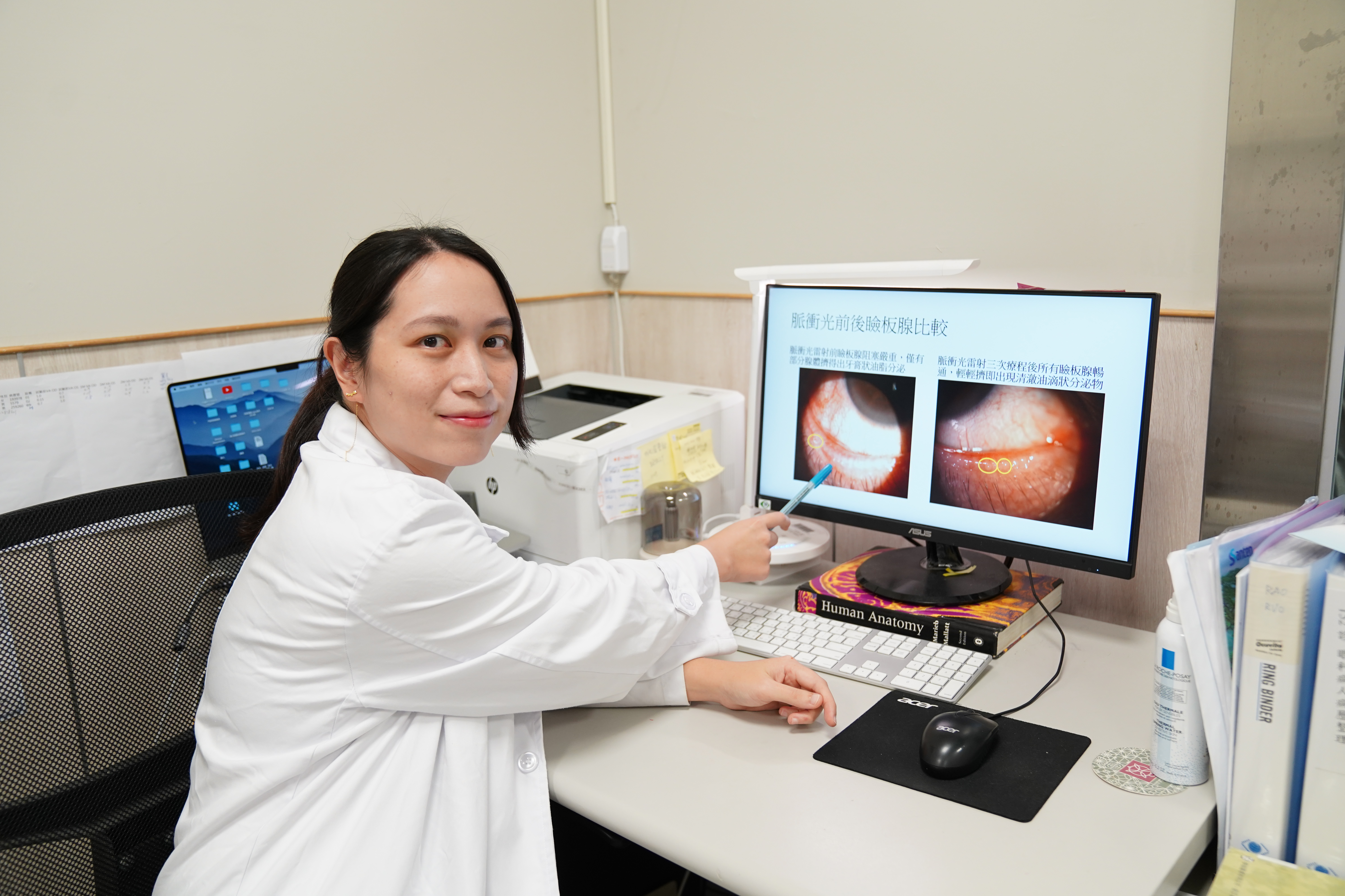 醫師邱瓊儀透過脈衝光雷射，治療病患乾眼症合併眼瞼炎。（中國醫藥大學新竹附設醫院提供）