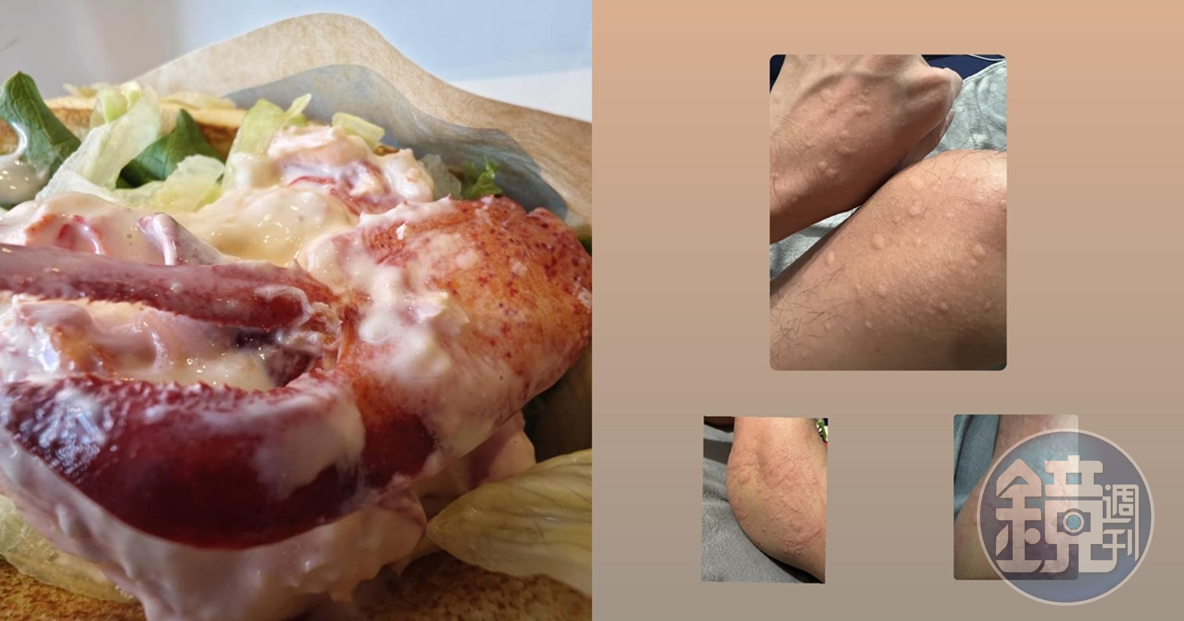 有民眾吃完麥當勞的螯龍蝦堡後嚴重過敏，整個人變成「紅色波羅麵包超人」。（翻攝自PTT、●【爆廢公社二館】●臉書）