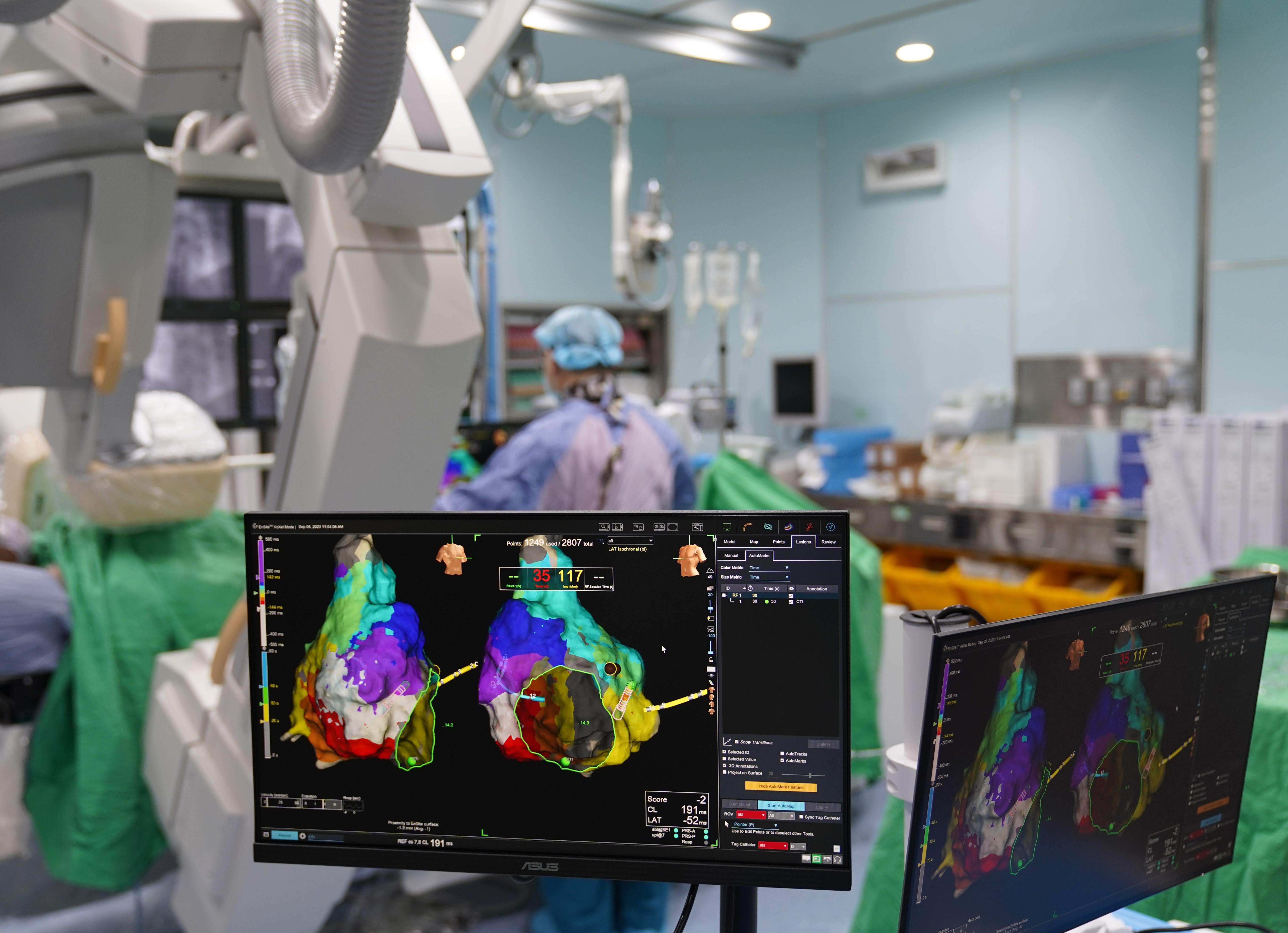 國外興起利用電燒心臟迷走神經節的治療方式，治癒迷走神經性暈厥的的病人。