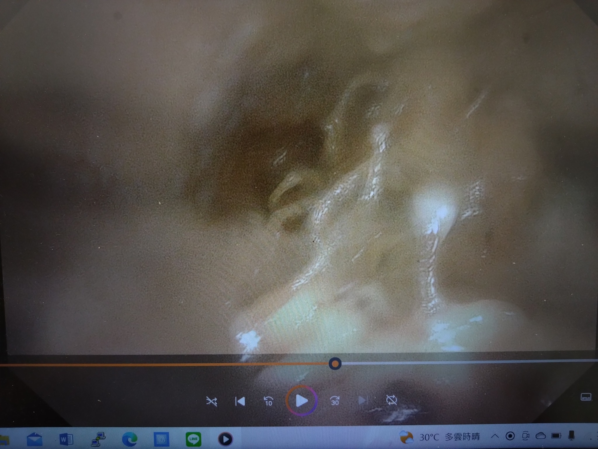 糙齒海豚胃內發現數條的人造線狀物。(翻攝自中華鯨豚協會 Taiwan Cetacean Society臉書)