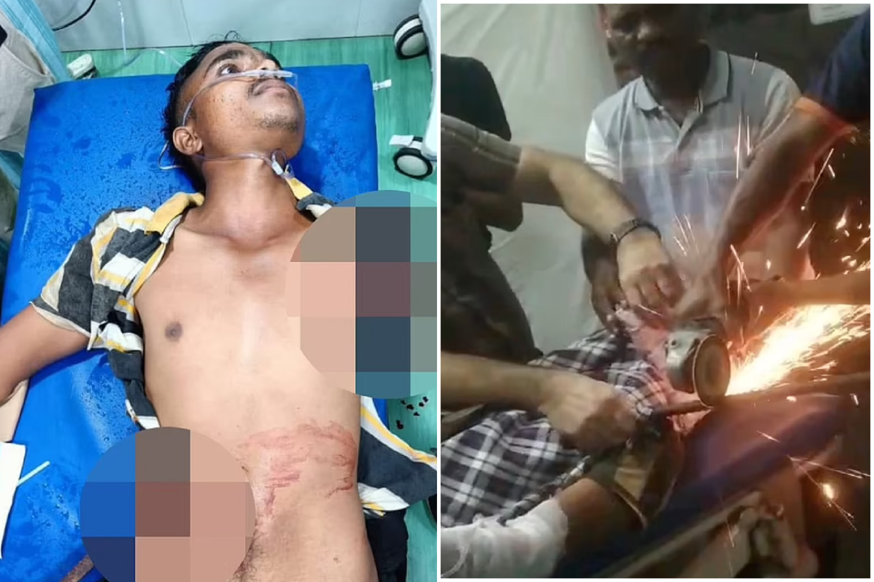 工人慘變「鋼鐵人」，遭2長鋼筋刺穿身體！他活下來了。（翻自《每日郵報》）