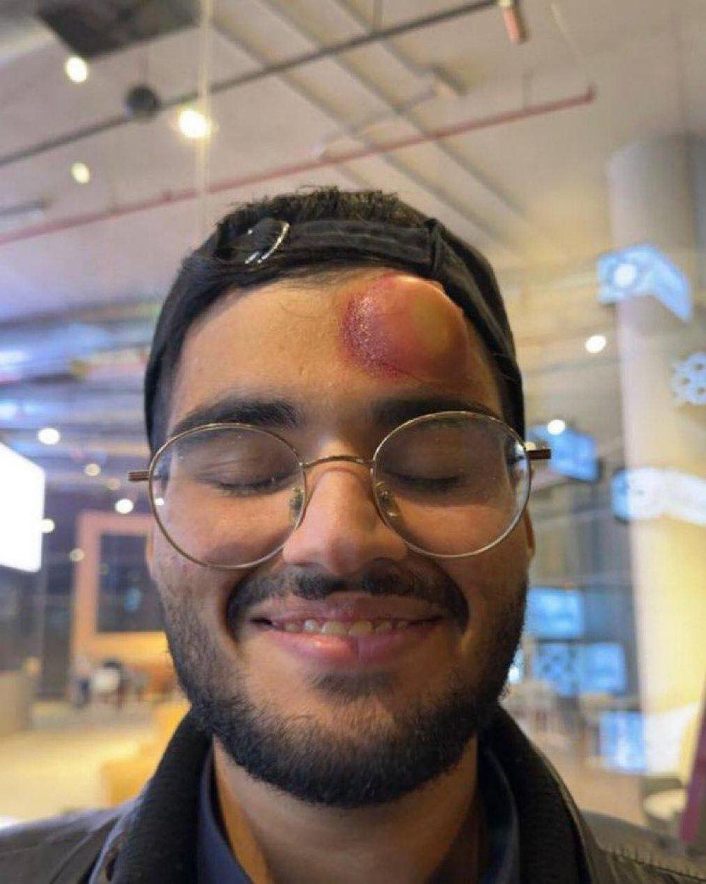 網路瘋傳照片中男子為遭C羅強球擊中的攝影師，不過消息已經遭到澄清。（翻攝自Football Hub推特）