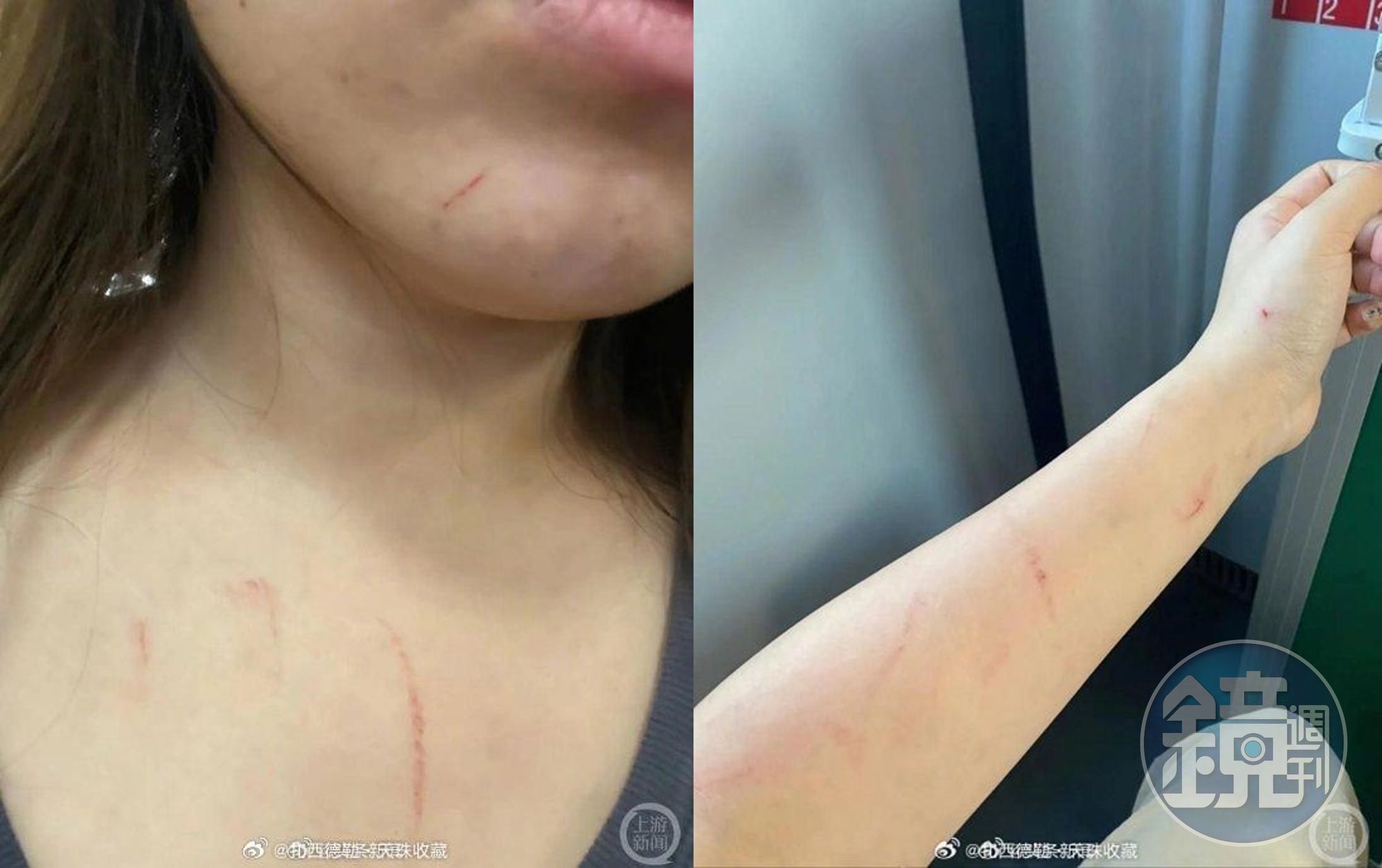李女因拒絕換位置遭到毆傷,脖子、手部都有明顯抓痕。(翻攝微博)