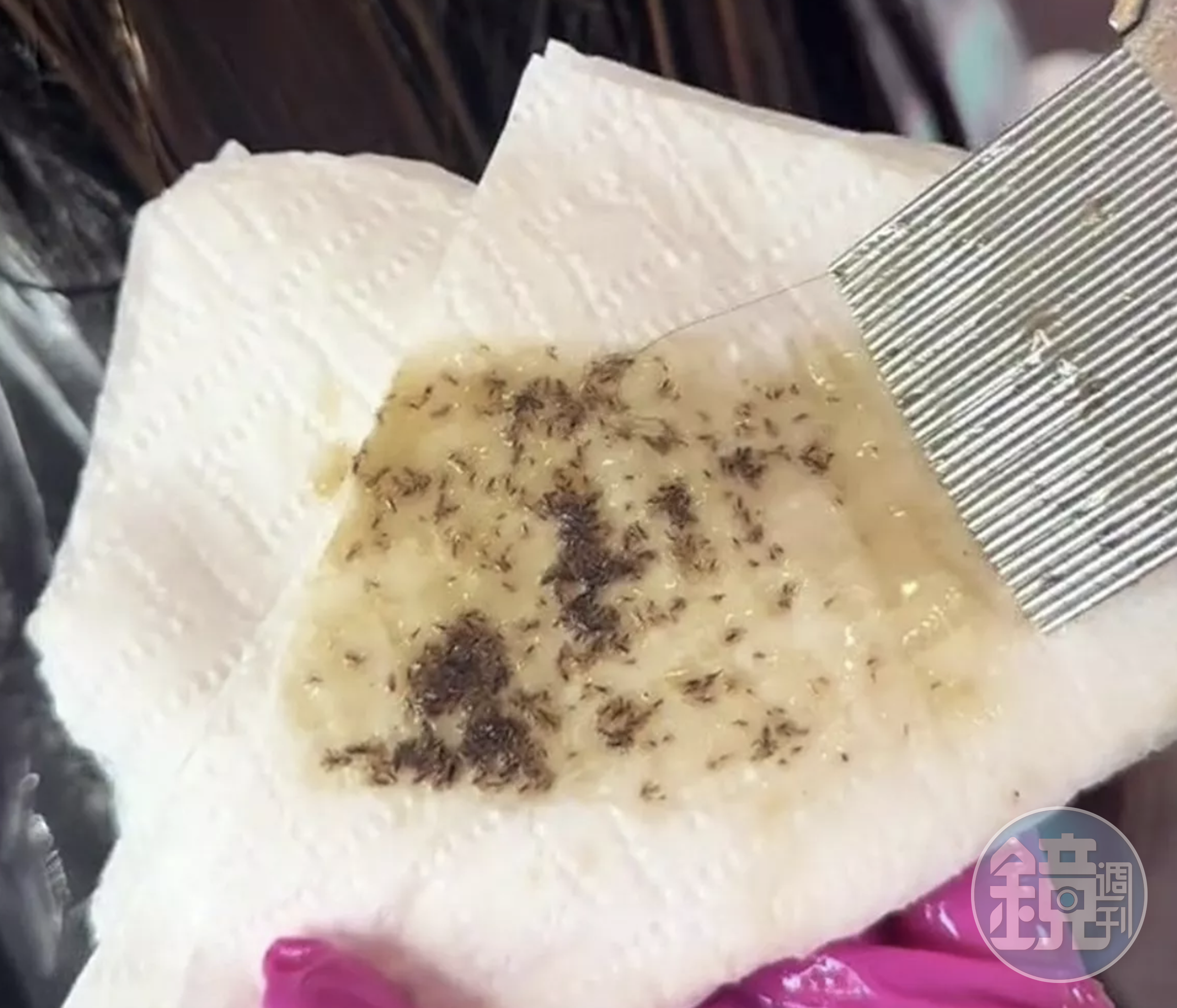 從頭皮清理下來的頭蝨及蟲卵。（翻攝TikTok@theliceangels）