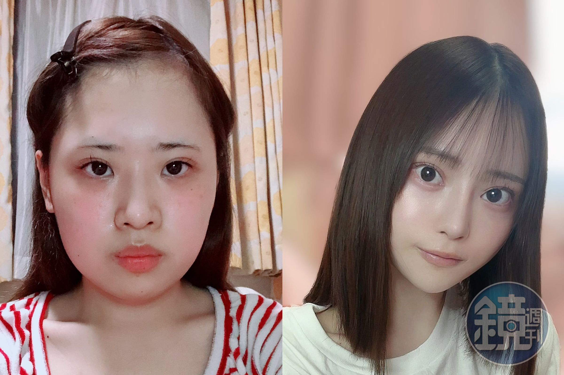 日本一名女子花費至少800萬日圓整形,成功變身成為一名正妹,手術前後照片引起網友熱議。(翻攝自@karinntter推特)