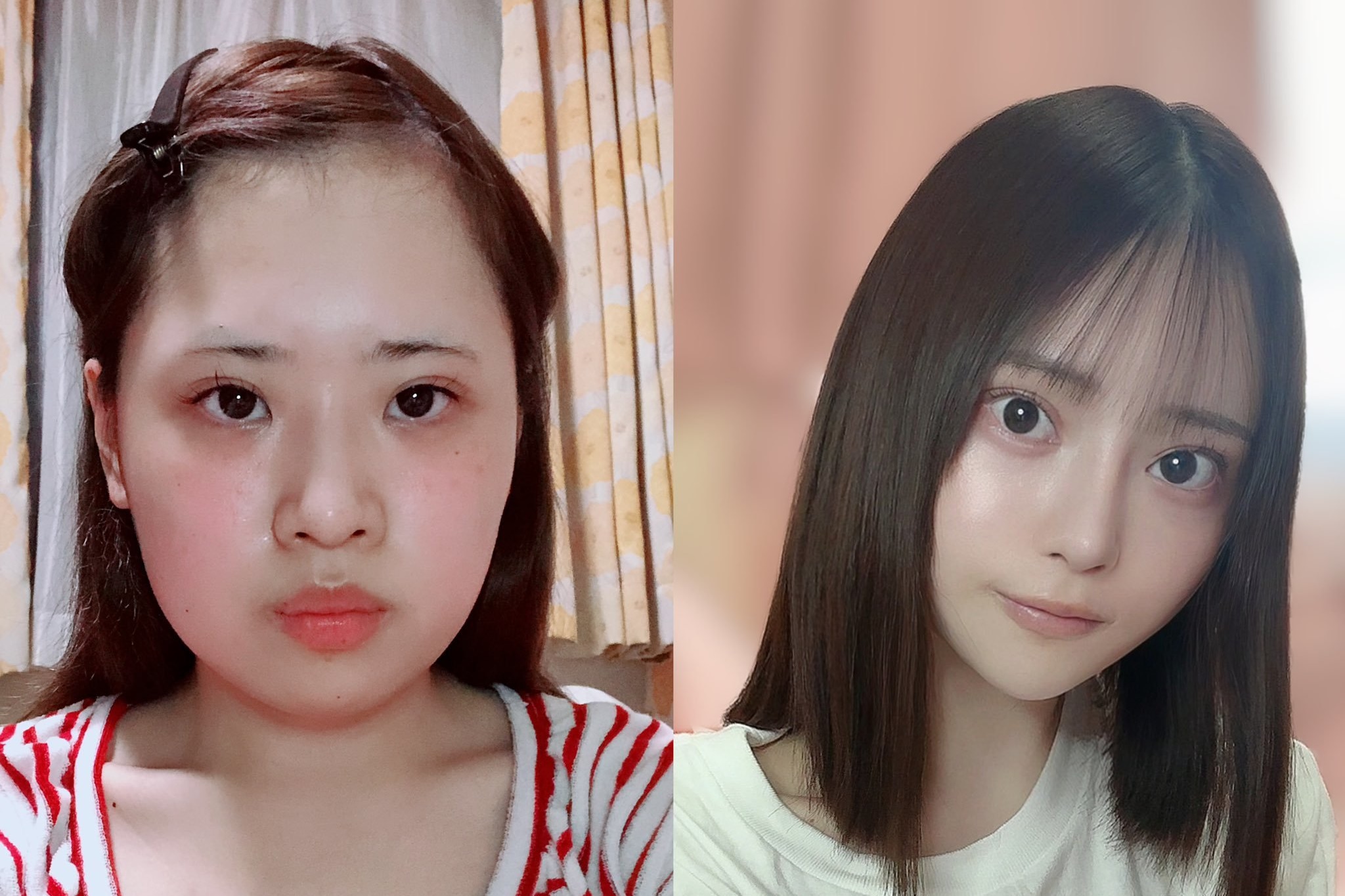 日本一名女子花費至少800萬日圓整形，成功變身成為一名正妹，手術前後照片引起網友熱議。（翻攝自@karinntter推特）