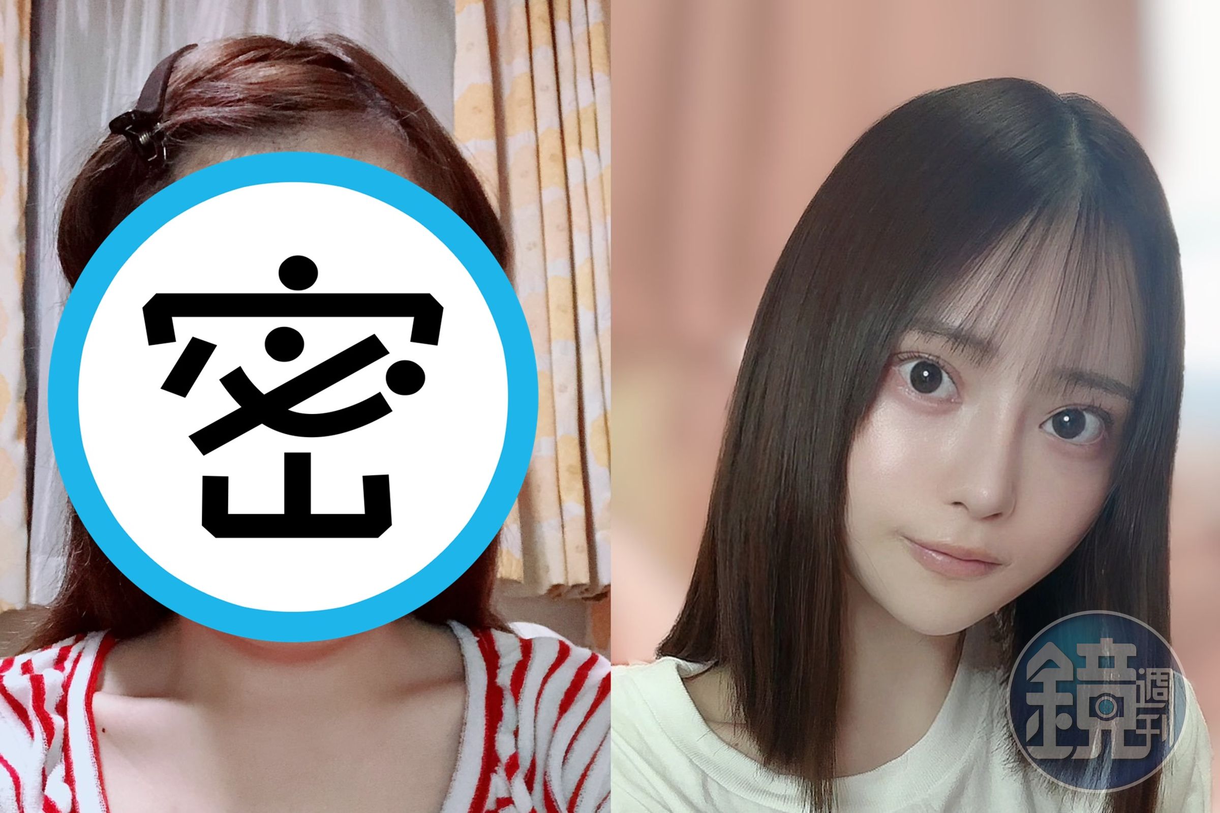 日本一名女子花費至少800萬日圓整形,成功變身成為一名正妹,手術前後照片引起網友熱議。(翻攝自@karinntter推特)