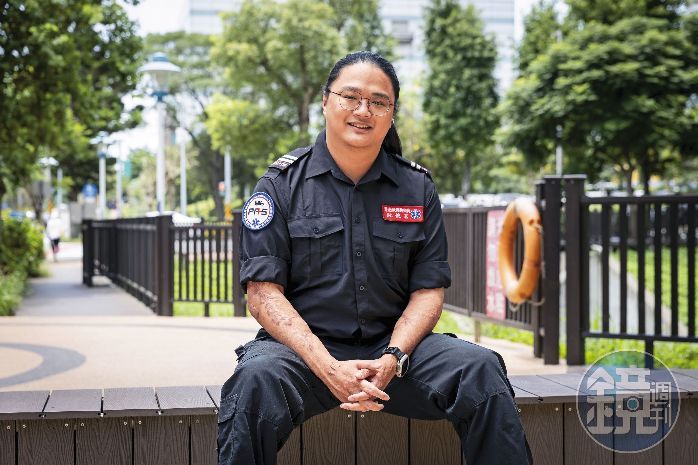 阮俊茗雙手都有明顯的燒燙傷疤，疤痕造成攣縮，加深救護工作的難度，但他都一一克服了。