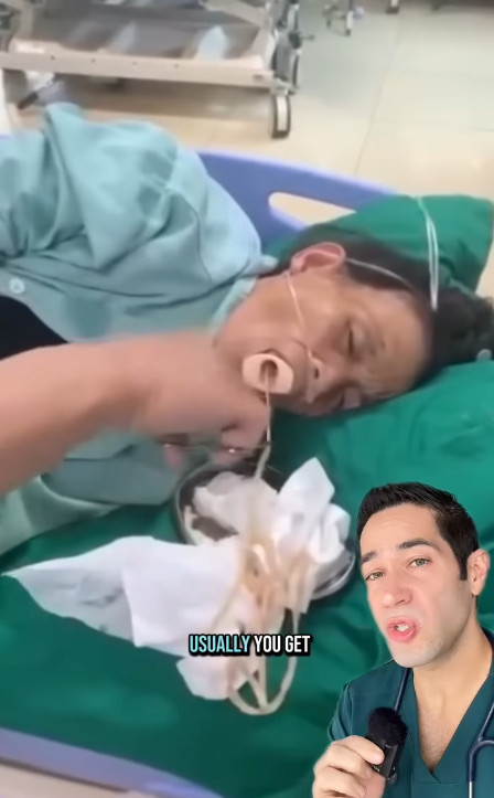 一名女病患照胃鏡時被發現有寄生蟲,醫護人員拿工具幫她拉出寄生蟲。(翻攝IG@doctormyro)