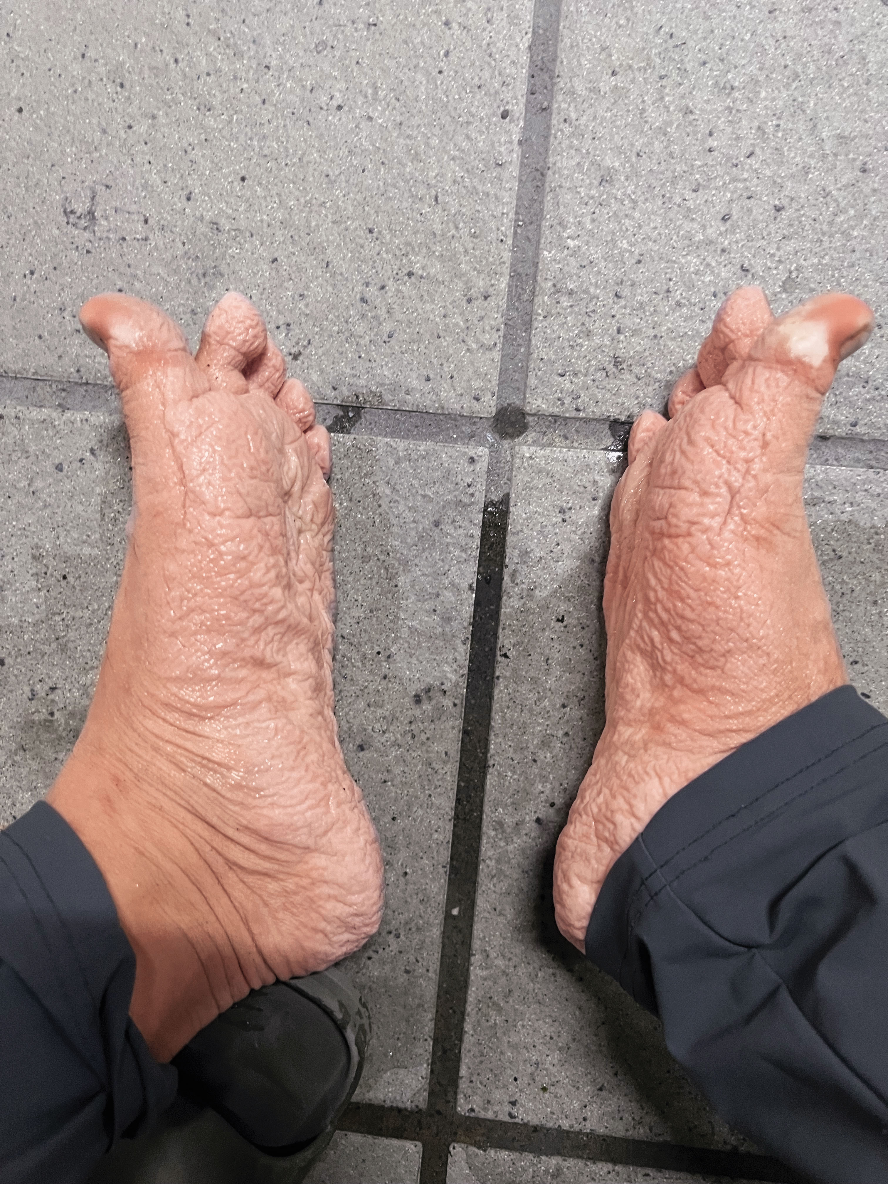 擔任馬太鞍溪志工期間，蔡智豪連續數日雙腳浸泡泥水之中，拔下雨鞋時，腳皮已經起皺發白。（蔡智豪提供）