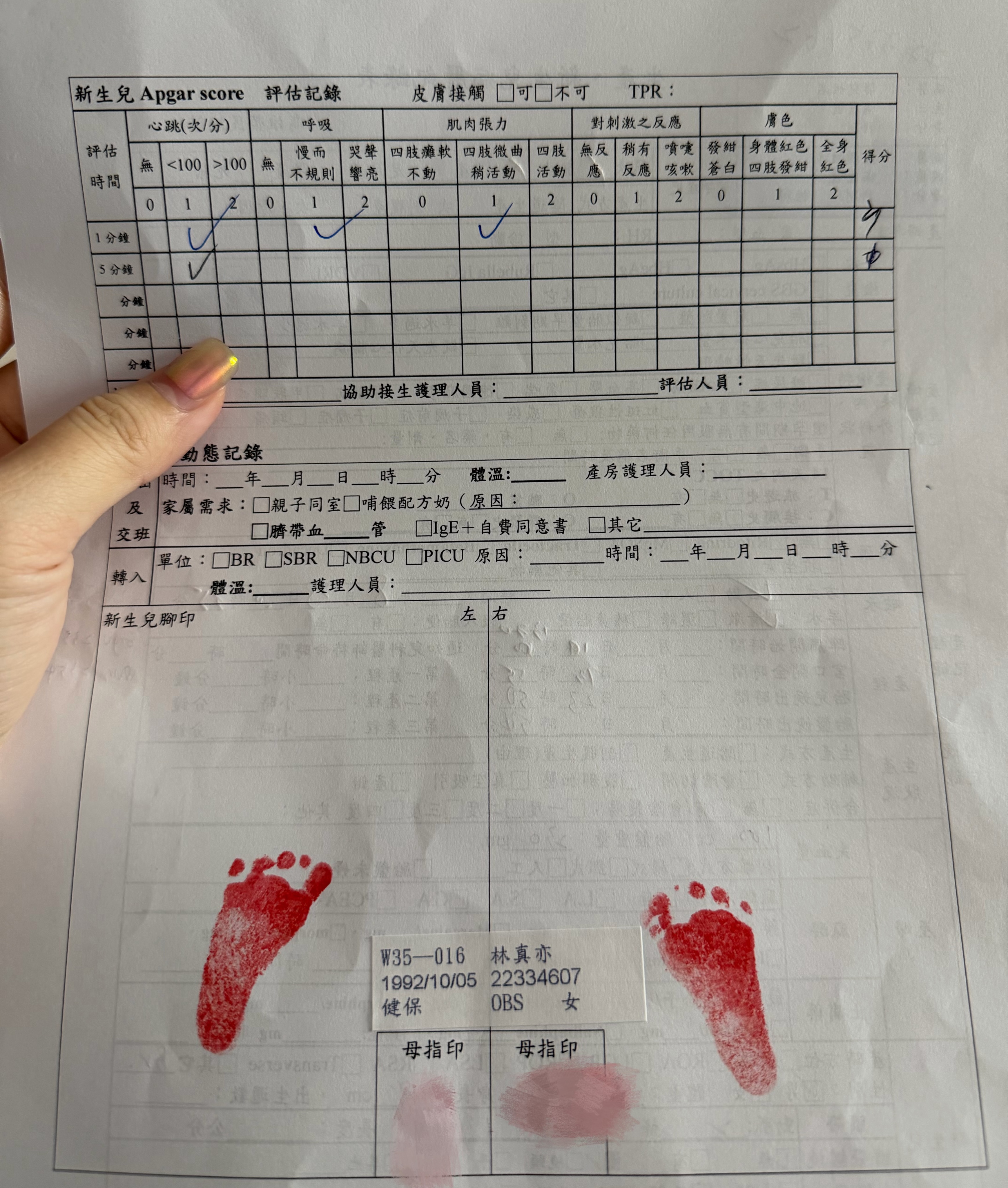 引產後，林真亦也曬出寶寶留下的小腳印，以及17週時在超音波中露出微笑的畫面。（翻攝自林真亦 IG）