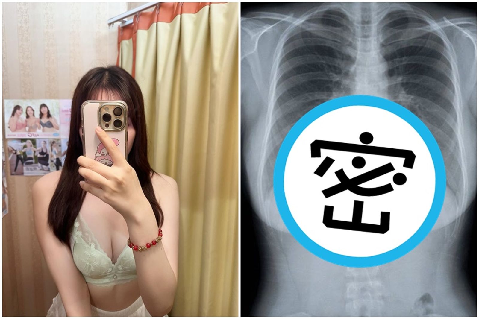 網紅「兔兔」擁不科學好身材,近日分享X光片照。(翻攝自Threads)
