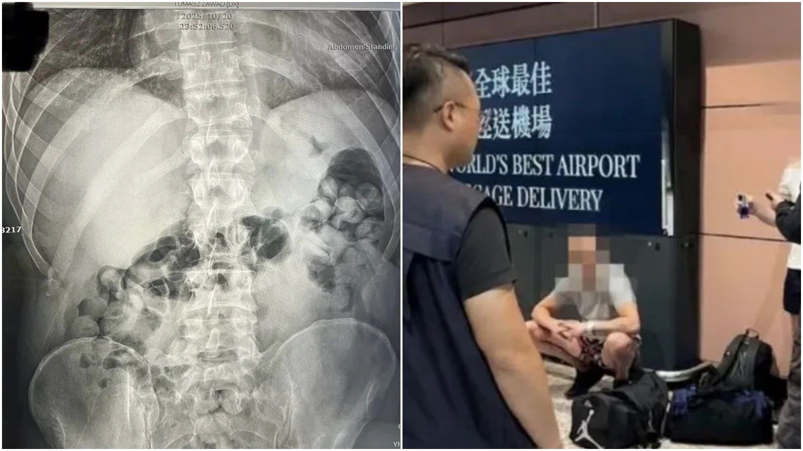 人體吞毒闖關機場!台美聯手破14起跨境運毒案 查獲海洛因23.3公斤、逮22人