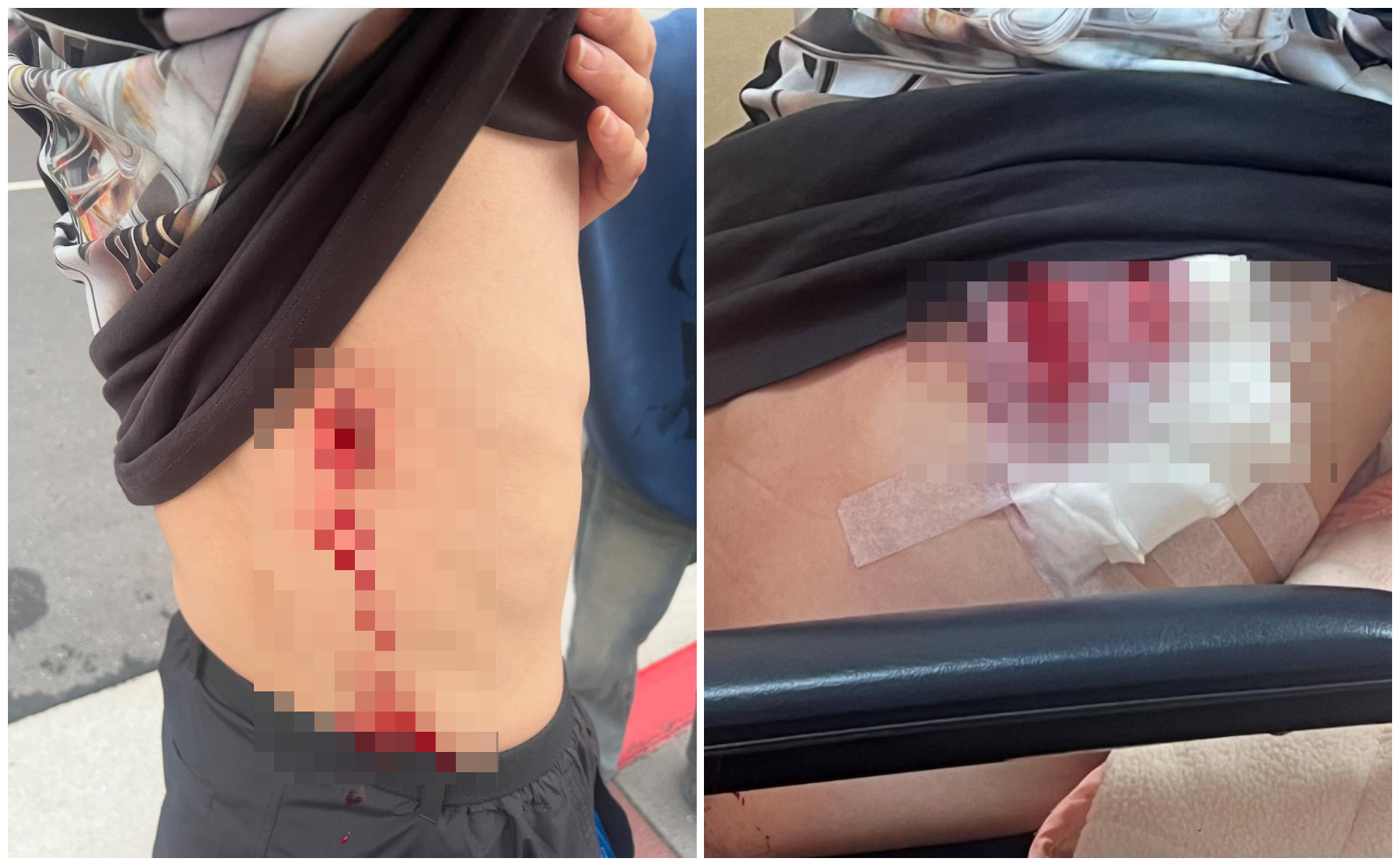 南韓留學生在西門町遭砍傷，他曬出濺血照，怵目驚心。（翻攝Threads）