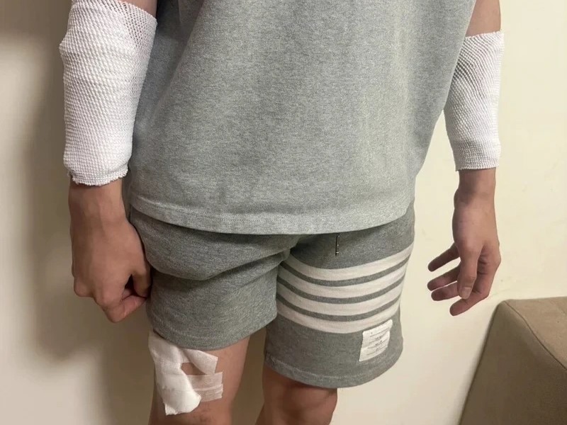 一名男護理師報案自稱遭人持美工刀砍傷,但警方調查後發現整起事件為自導自演。(翻攝畫面)