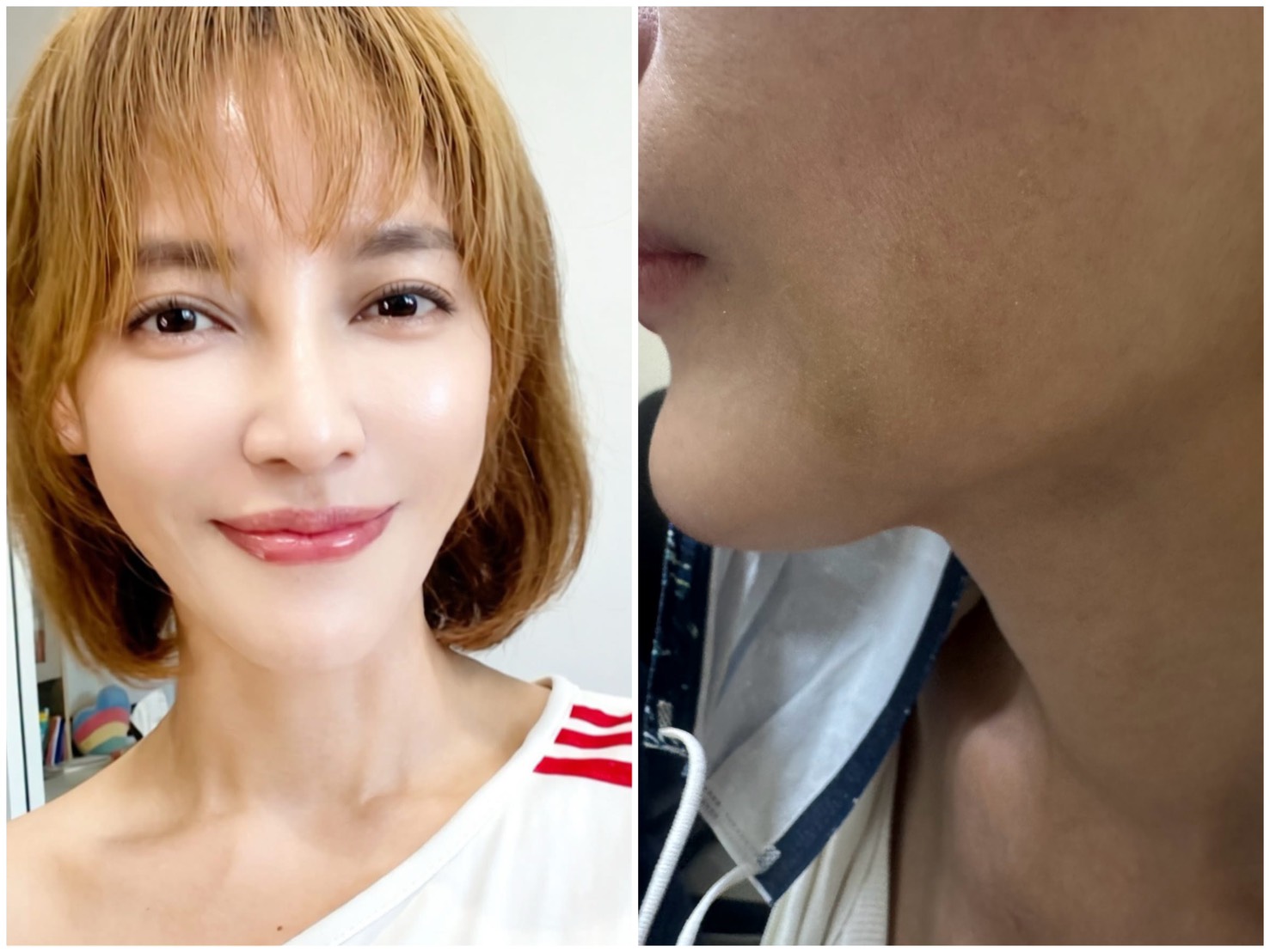 李沛綾一向維護螢幕形象,卻因遭家暴體無完膚。本人提供