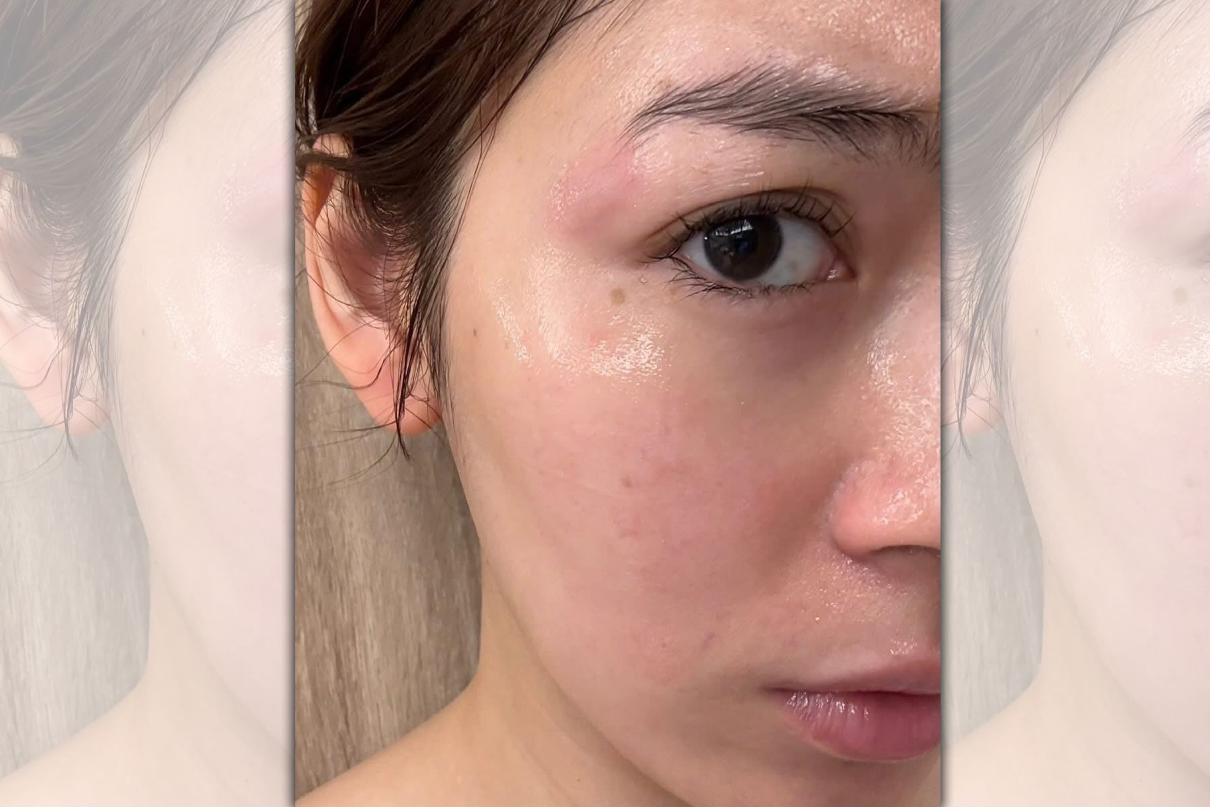 在台北生活近十年馬來西亞女星劉倩妏 ，上月底在大安區某髮廊洗髮、做造型，卻遭高溫捲髮棒燙傷左臉。（讀者提供）