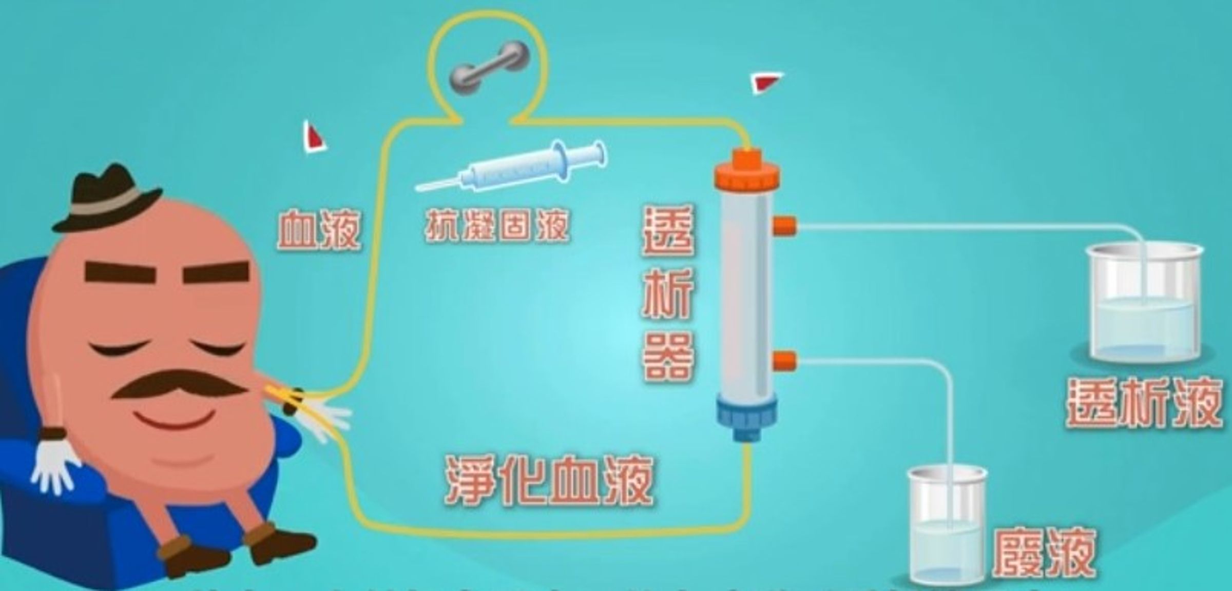 洗腎和換腎相比，洗腎後的生活品質會變差，日後發生心血管病變的機率也會增加。(翻攝台灣腎臟醫學會官網)