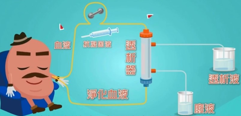 洗腎和換腎相比，洗腎後的生活品質會變差，日後發生心血管病變的機率也會增加。(翻攝台灣腎臟醫學會官網)