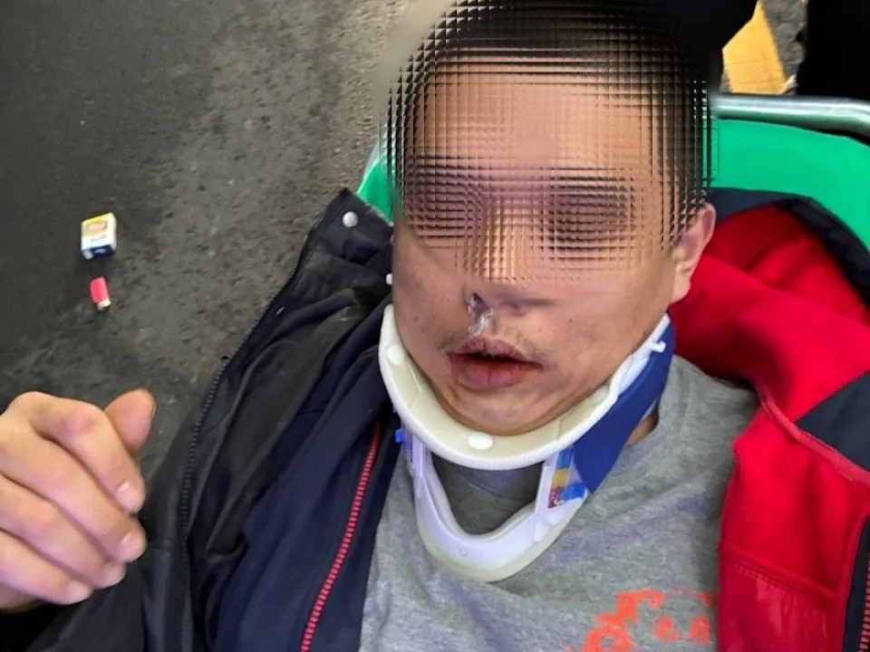 新北市淡水區淡江大學校門口6日下午，一名32歲黃姓男子騎機車行經校門口時突然自摔倒地。（淡水警分局提供）