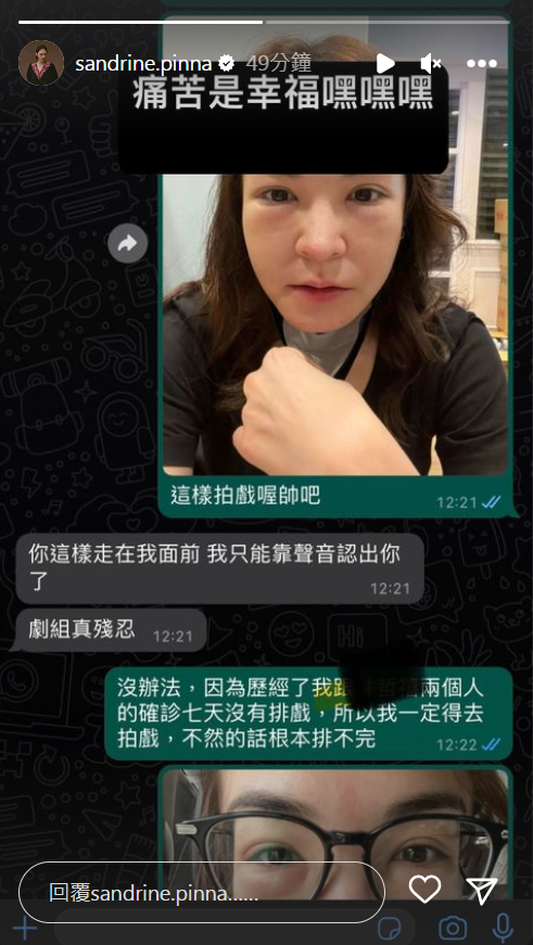 張榕容頂著大腫臉去拍戲。(翻攝自張榕容IG)