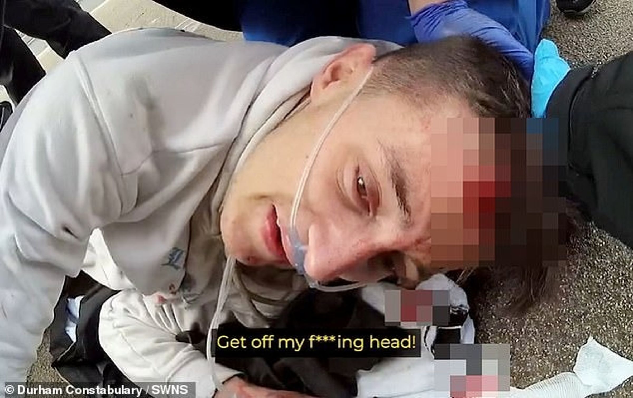 帕克一度口氣極差地對急救人員大喊「他X的不要碰我的頭！」。（翻自《每日郵報》）