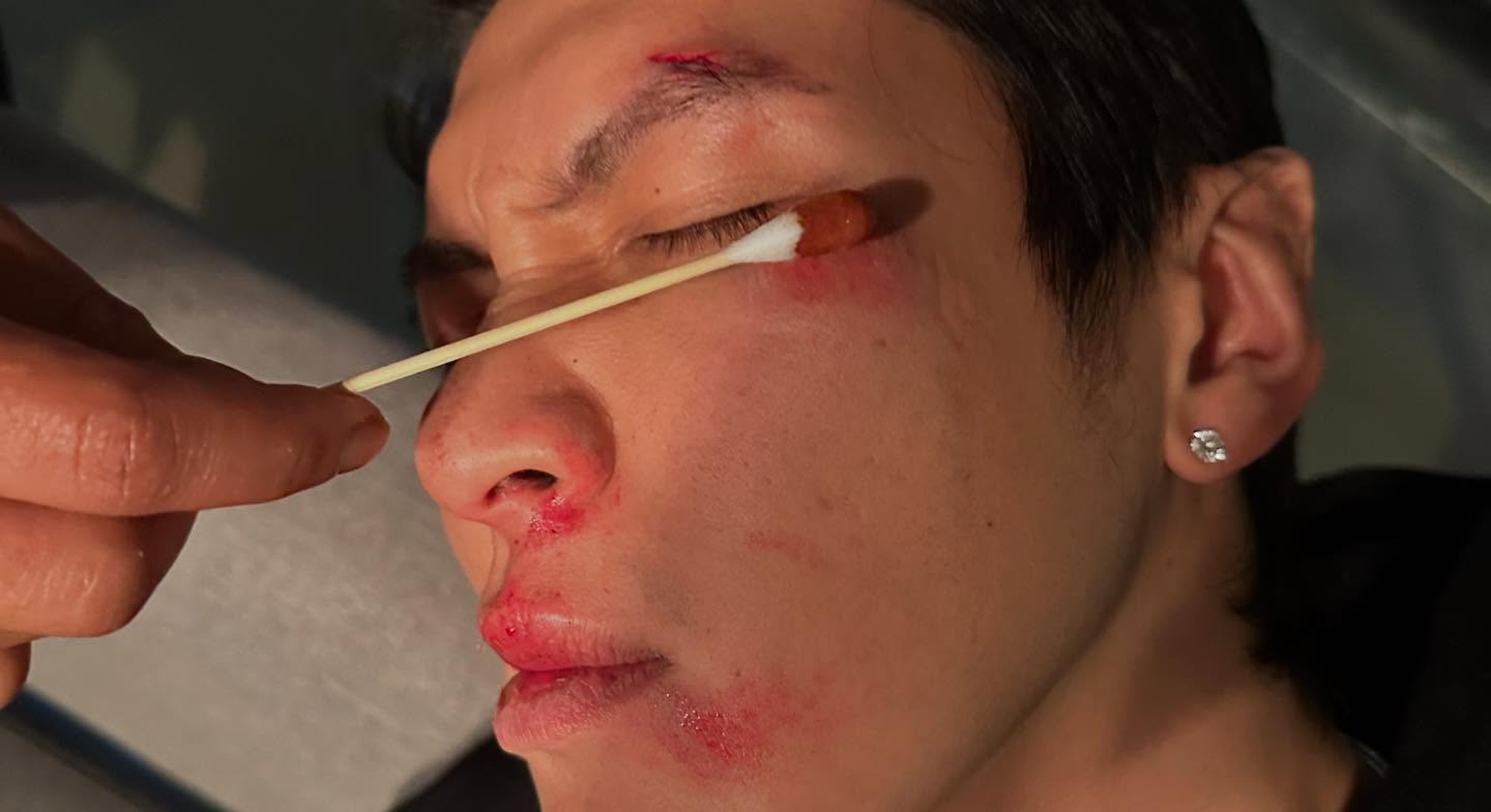 回顧照片中也包括柯震東拍戲受傷,臉部濺血險些破相的現場照。(翻攝柯震東IG)