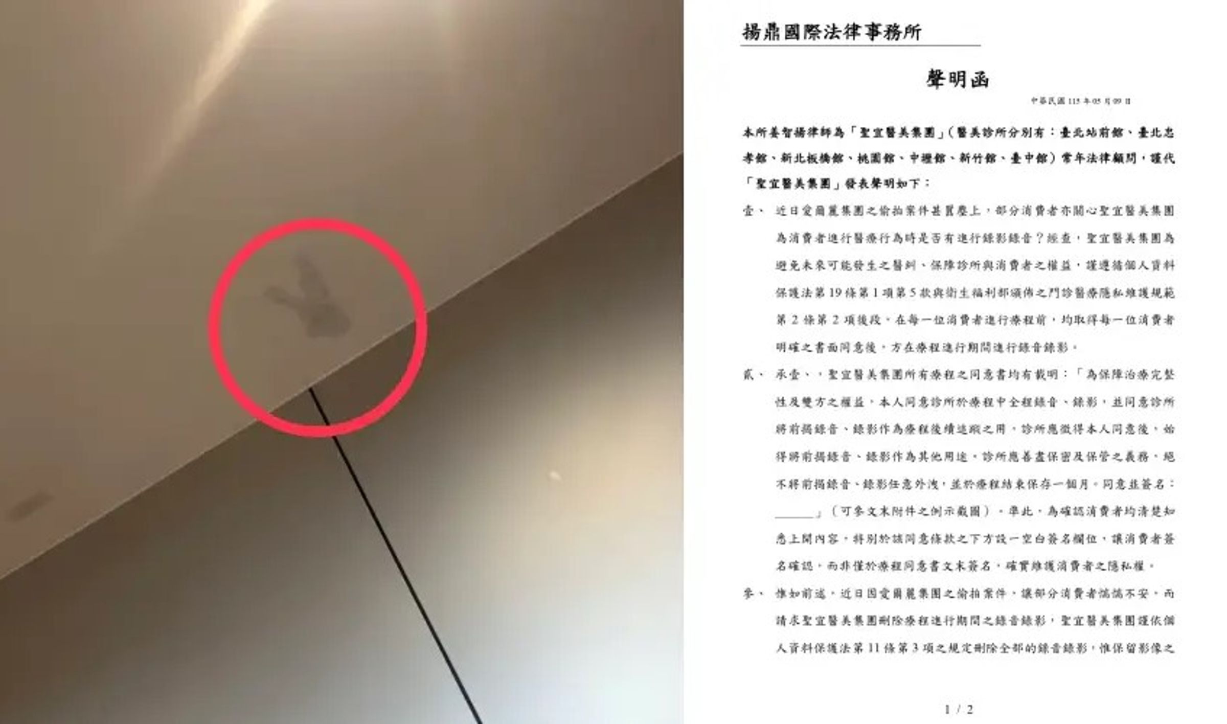 有網友PO照控訴聖宜診所桃園店的天花板疑似有錄影設備拆除的痕跡(左圖);針對診間監視器風波,聖宜診所透過律師發布聲明,強調錄影是為了釐清醫療爭議,且所有患者均簽署同意書。(翻攝自Threads、診所臉書)