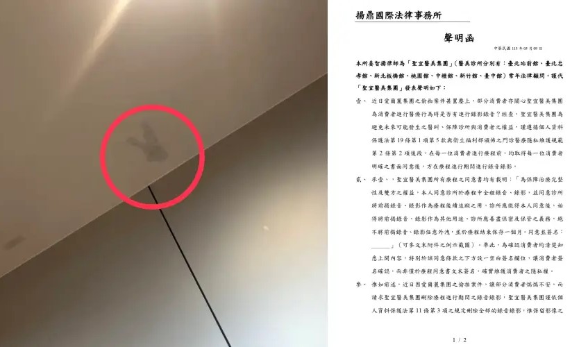 有網友PO照控訴聖宜診所桃園店的天花板疑似有錄影設備拆除的痕跡(左圖);針對診間監視器風波,聖宜診所透過律師發布聲明,強調錄影是為了釐清醫療爭議,且所有患者均簽署同意書。(翻攝自Threads、診所臉書)