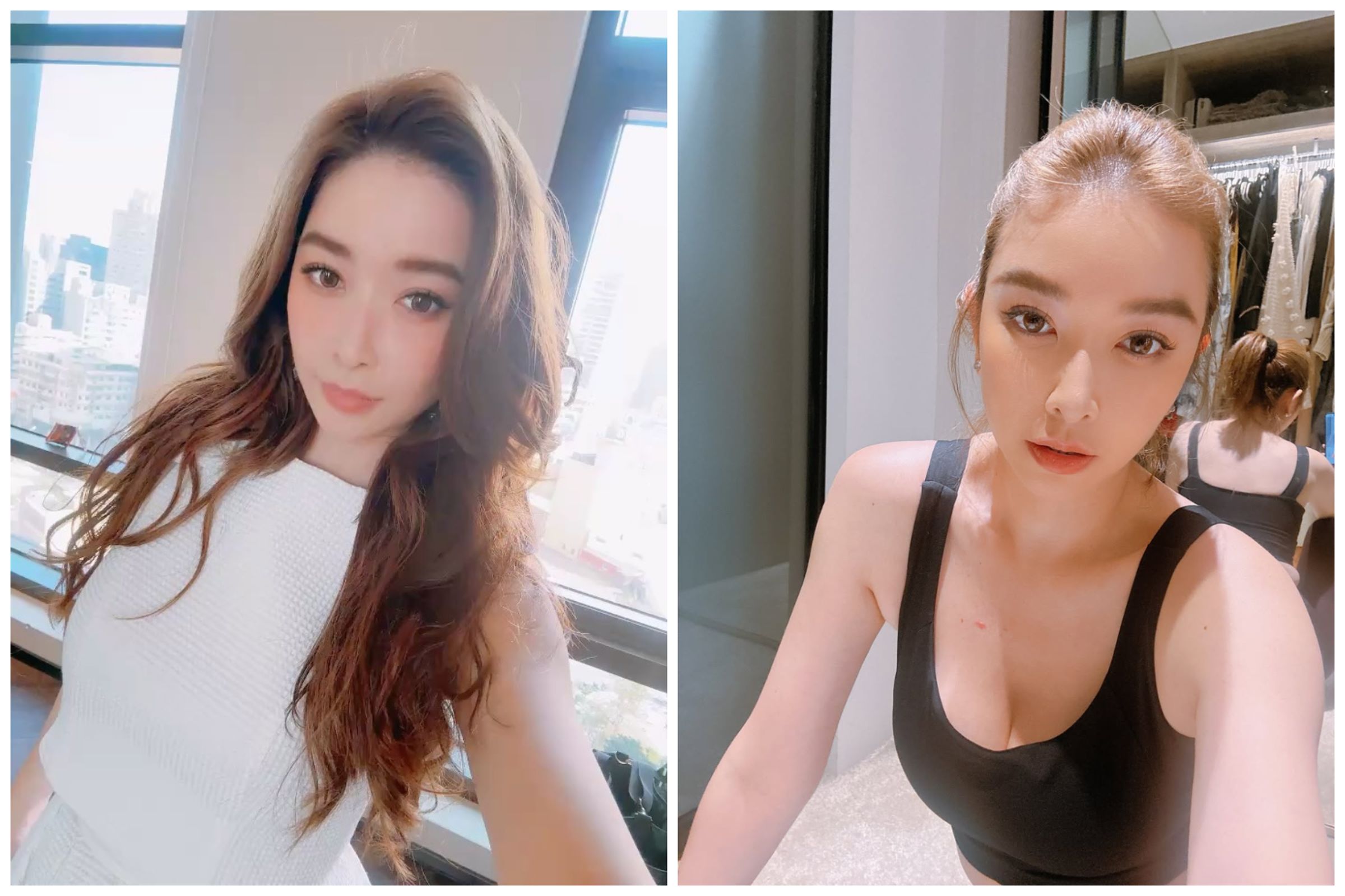 許維恩透露罹患乳癌，接受雙乳切除及重建手術。（翻攝sharon701111 IG）