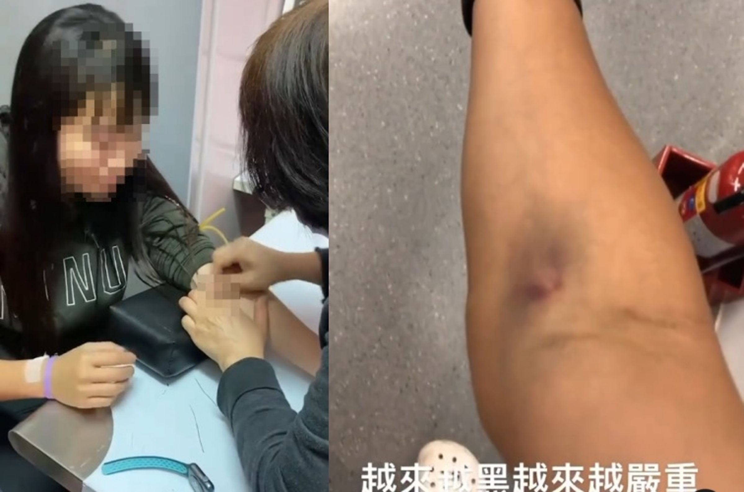 學生邊運動邊自己扎針取血，恐引發昏厥風險。（翻攝自受害簡姓學生Threads）