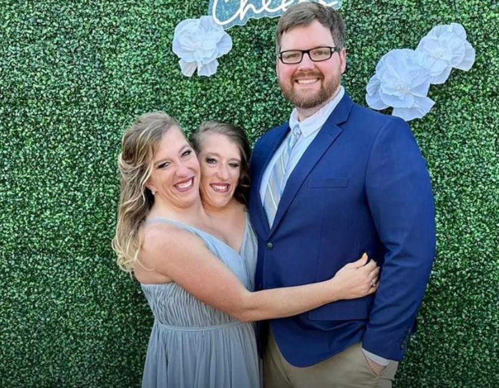 連體嬰姊妹艾比和布蘭特妮傳出與退伍軍人鮑林結婚。(翻攝X@Wealth__0)