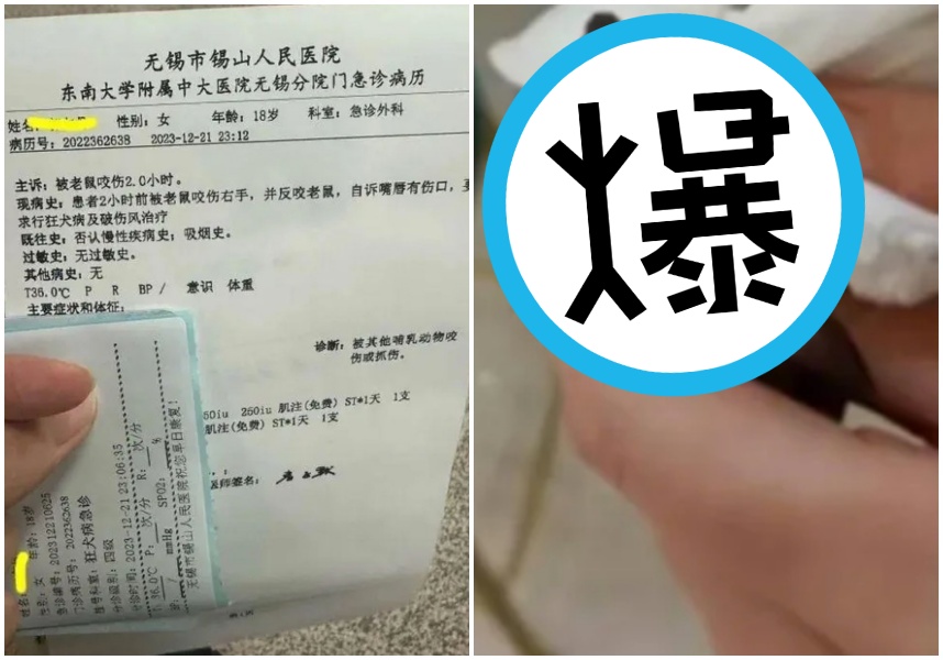 中國江蘇一名女大生抓老鼠被咬了一口，沒想到她一氣之下竟反咬回去。（翻攝自微博）