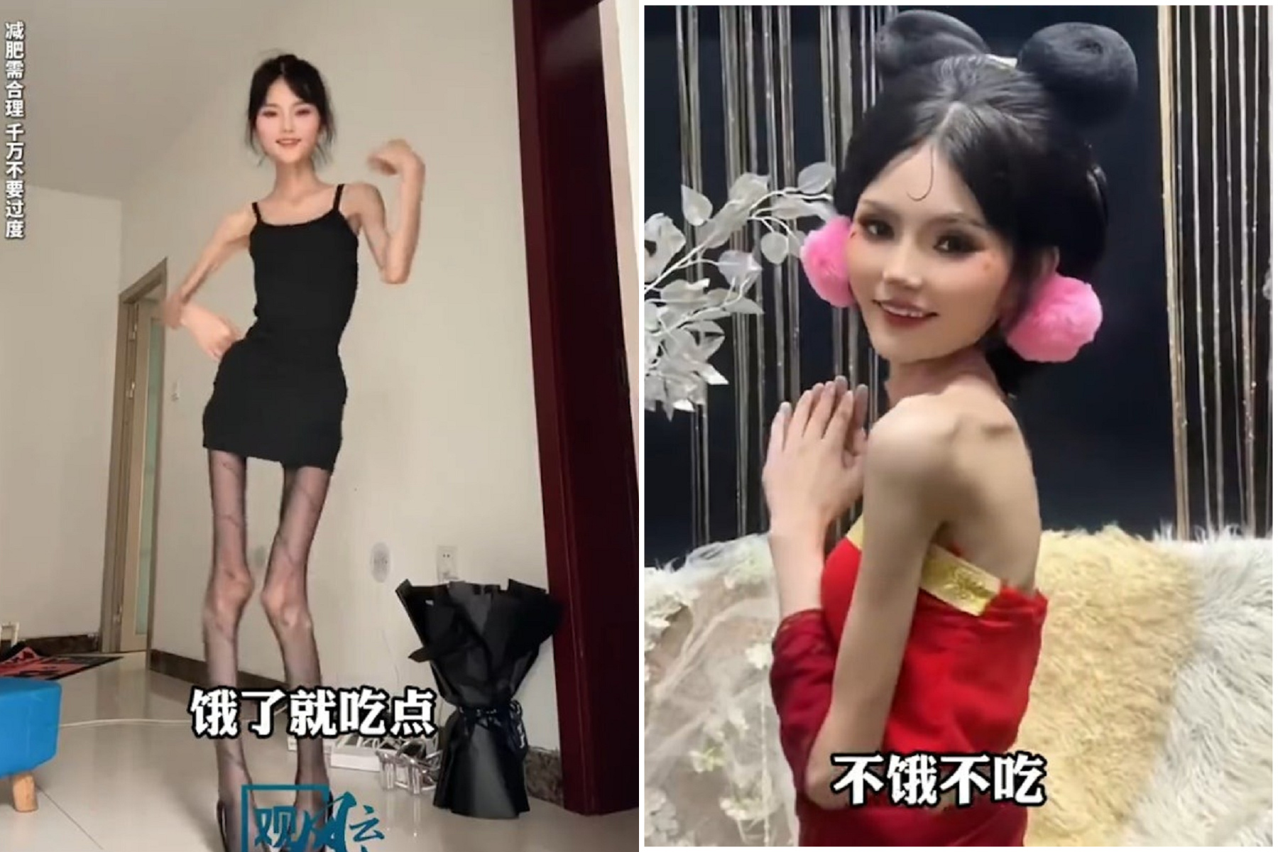 妹子160公分僅25公斤成紙片人，「我愛骨感還想瘦下去」。（翻自《極目新聞》）