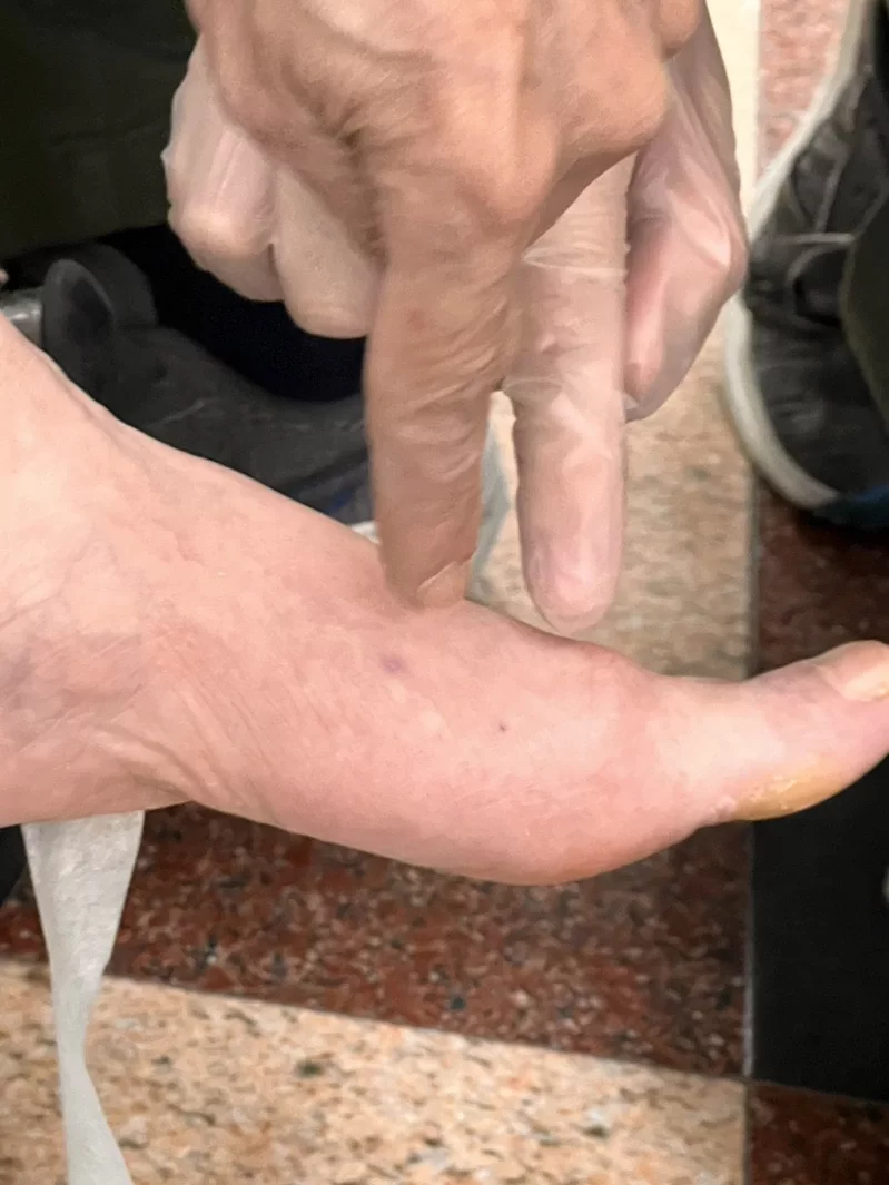黃秉雄提醒民眾遭蛇咬傷可將患處上緣包紮,減緩毒液擴散。(龜山消防分隊提供)