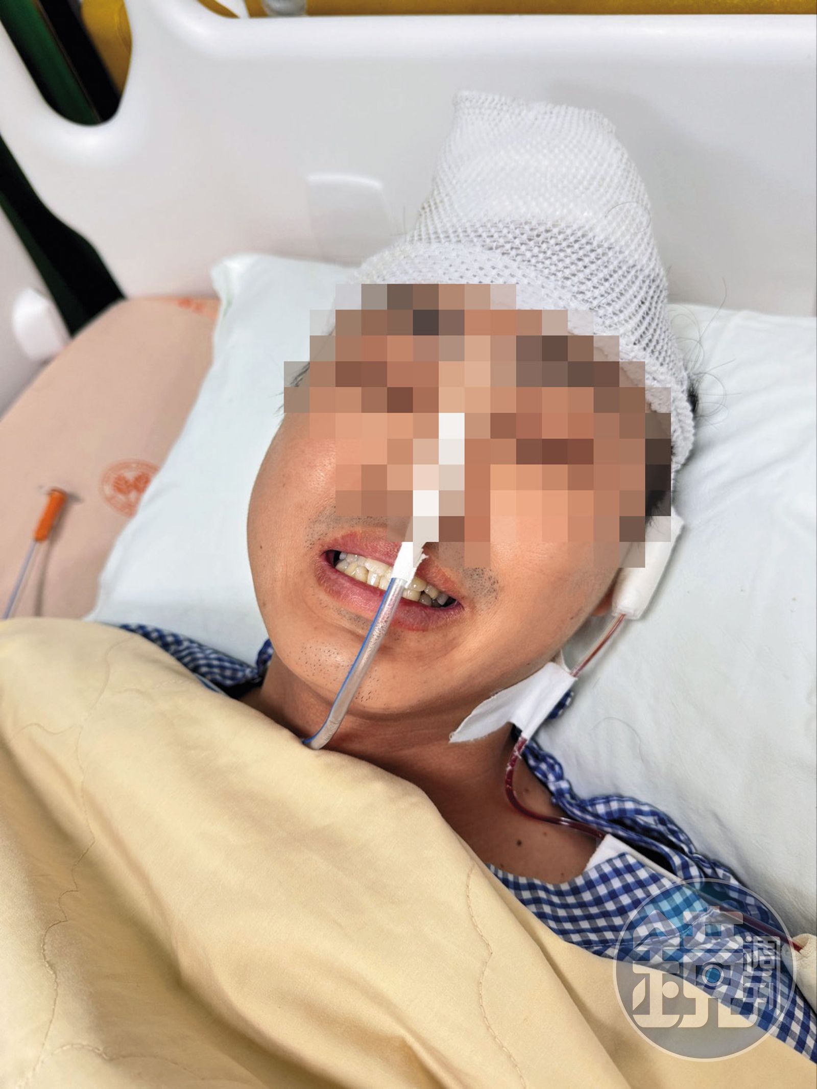 杜男術後住進加護病房，情況一度不穩，還有認知錯亂等後遺症。（讀者提供）