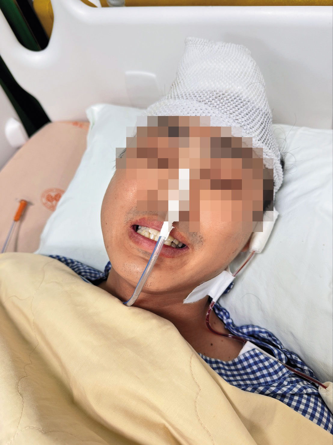 杜男術後住進加護病房，情況一度不穩，還有認知錯亂等後遺症。（讀者提供）