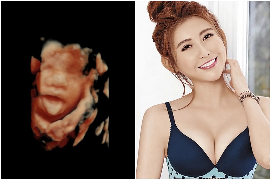 今(2日)愷樂突然在IG上PO出一張超音波照 ,宣布懷孕消息。(翻攝自愷樂IG、本刊資料照)