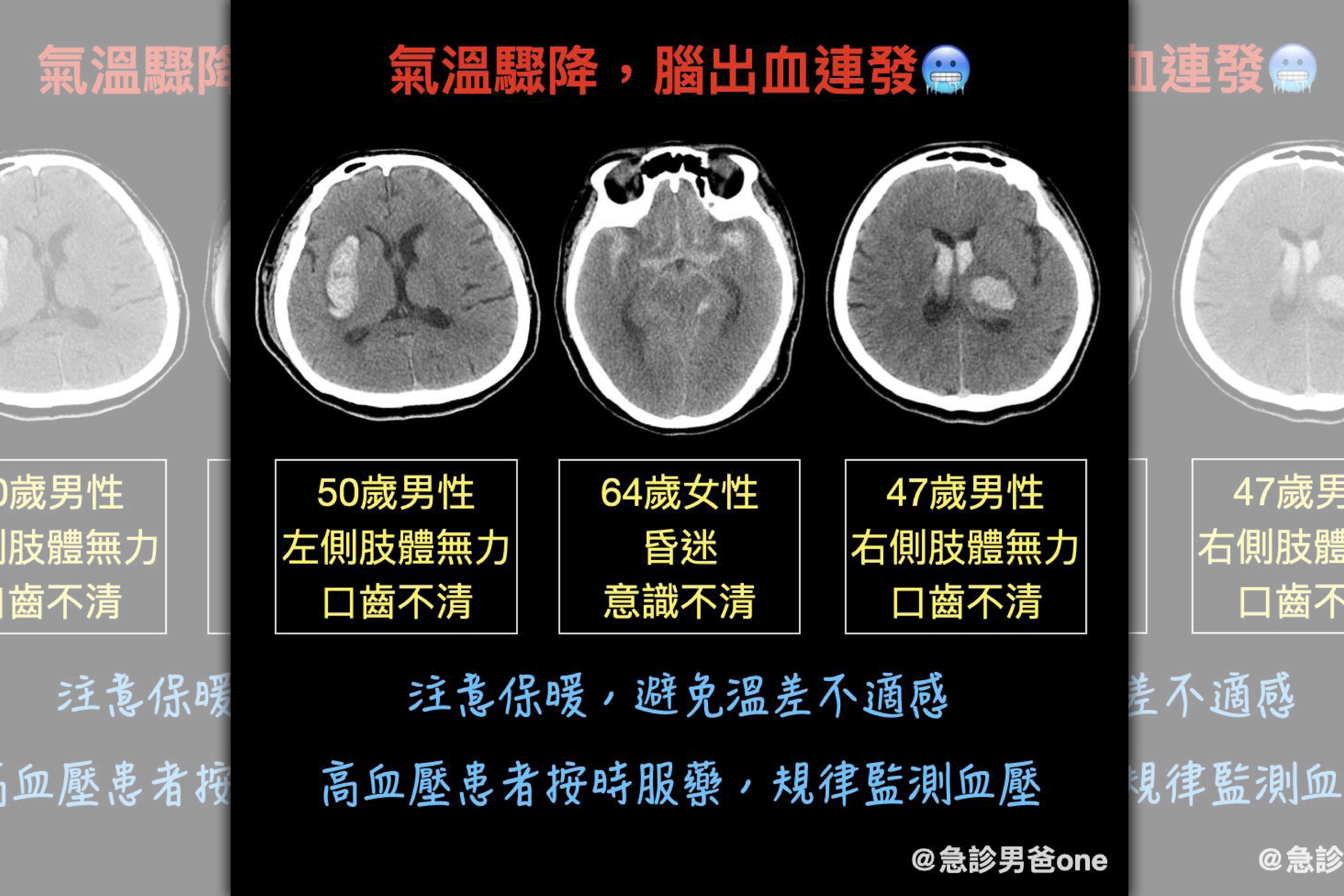 急診專科醫師表示，近日因氣溫驟降，上班短短一個小時就陸續收治3名腦出血病患。（翻攝自臉書粉專急診男爸one）
