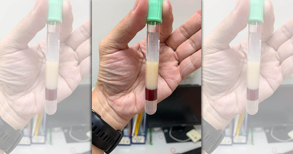 醫師陳志金曝１張圖「真的一層油」。（翻攝自臉書）