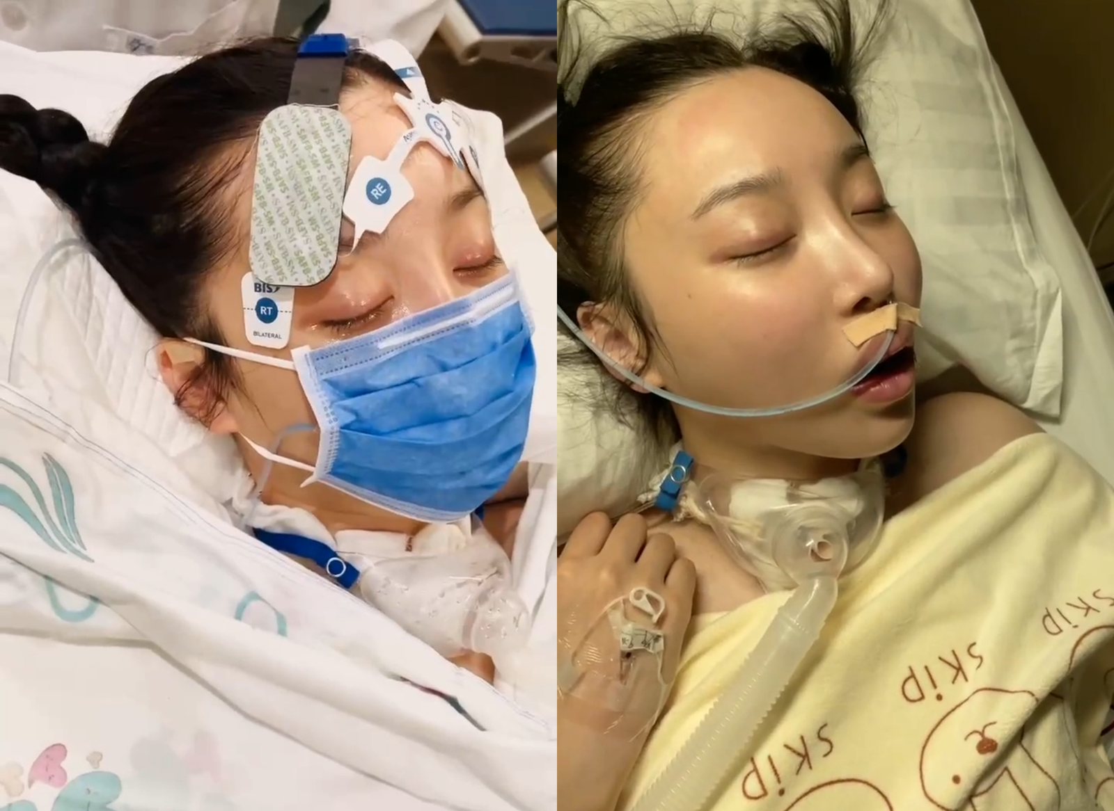中國女星肖妍倪3年前成為植物人,3個月後奇蹟般甦醒,但留下大量後遺症。(翻攝抖音@演員倪倪子)