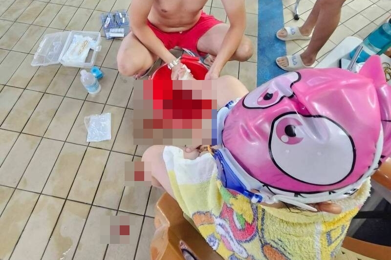 女童踩上破損磁磚,腳底當場被割傷血流如注,送醫後縫了6針。(市議員陳世軒提供)