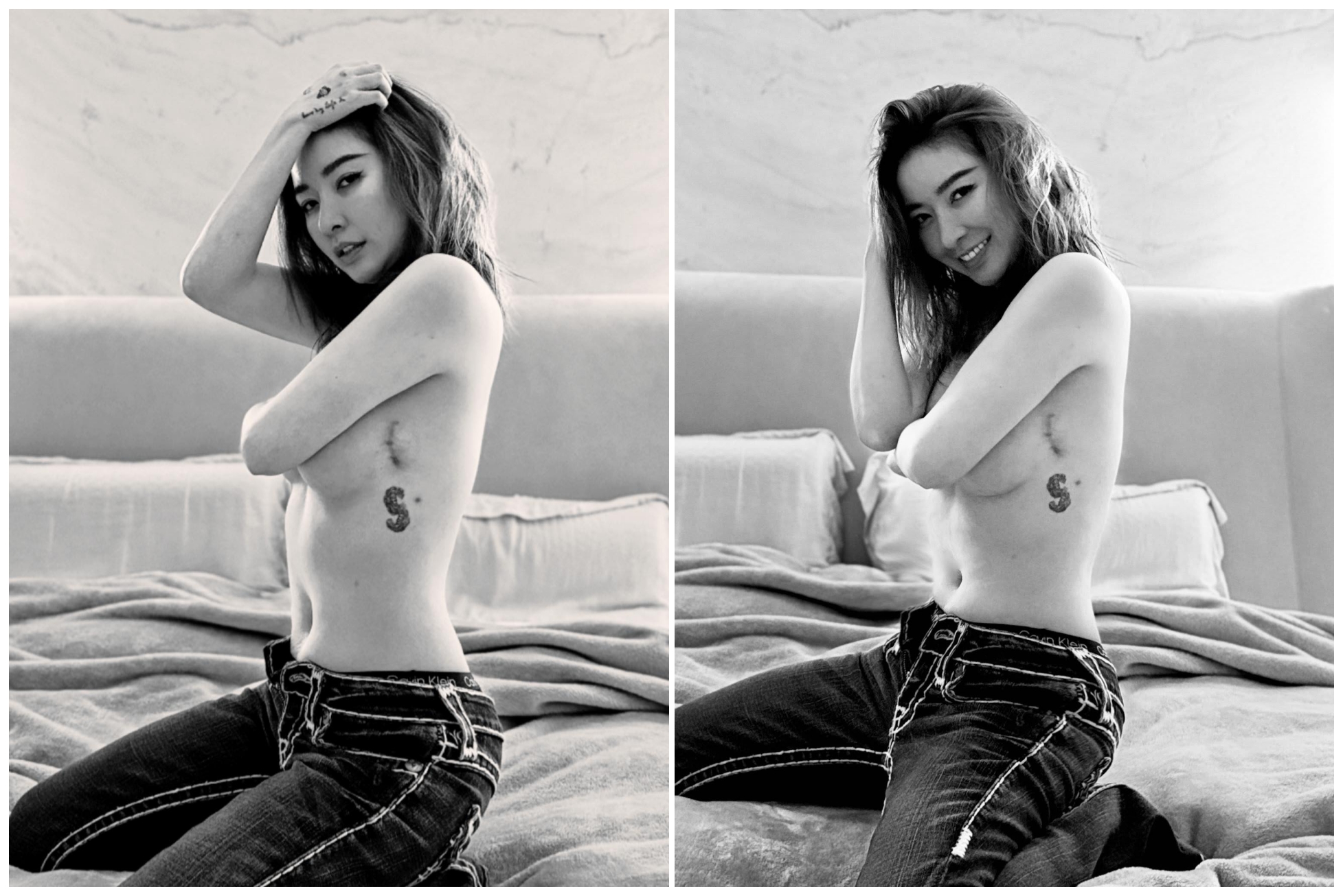 許維恩露出傷疤，認為每一道疤都是人生的「勳章」。（翻攝自臉書）