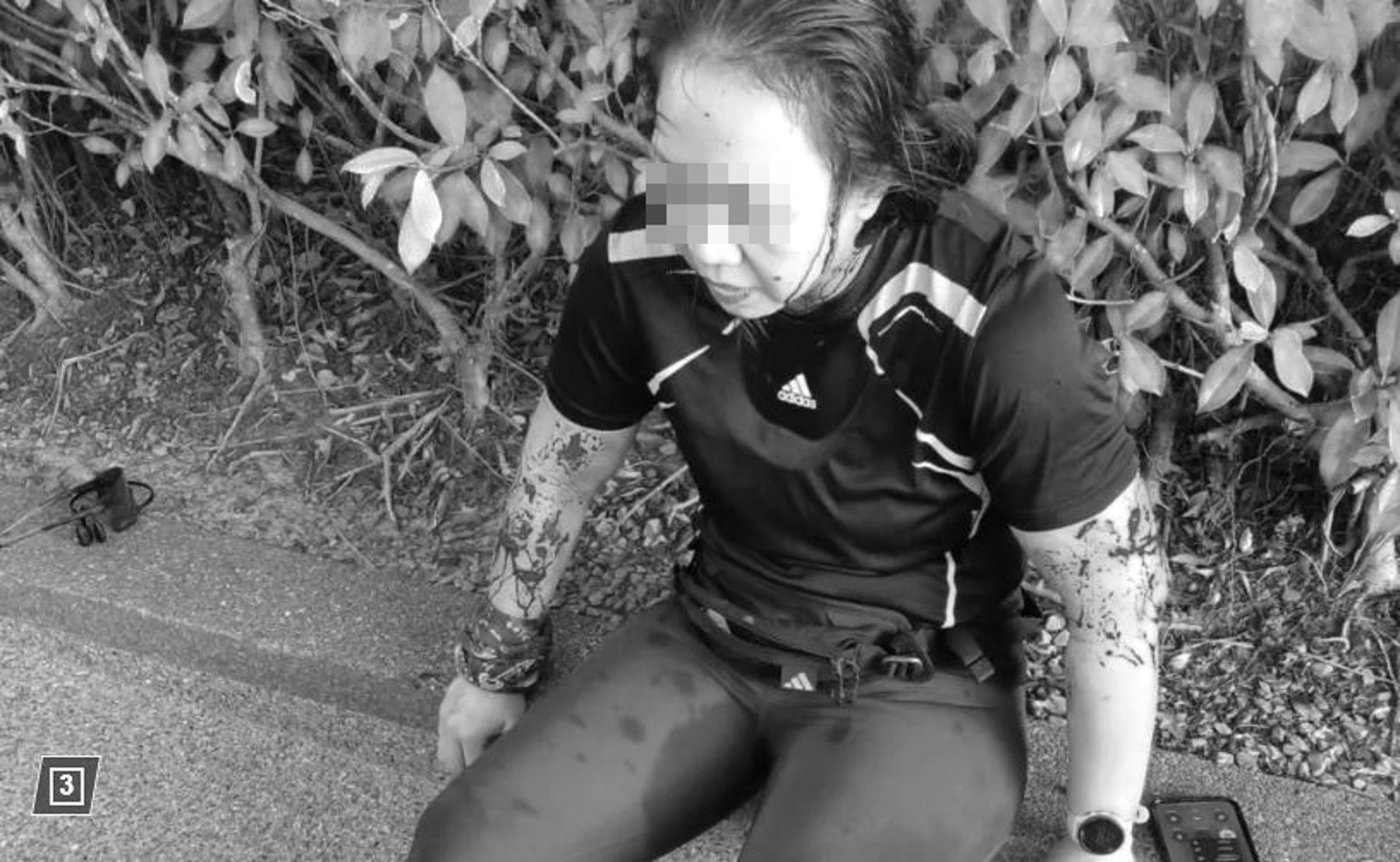 馬來西亞慢跑女全身是傷。(翻攝自紐約郵報)
