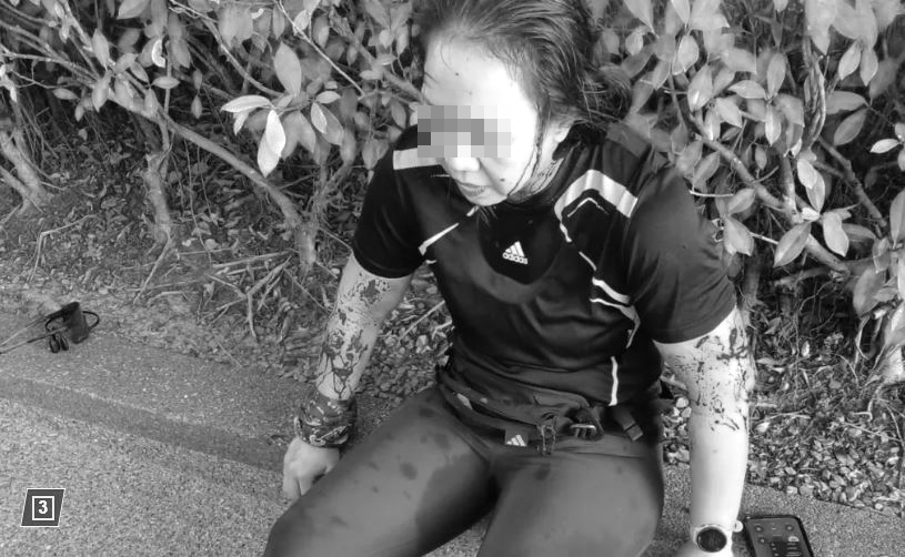 馬來西亞慢跑女全身是傷。(翻攝自紐約郵報)