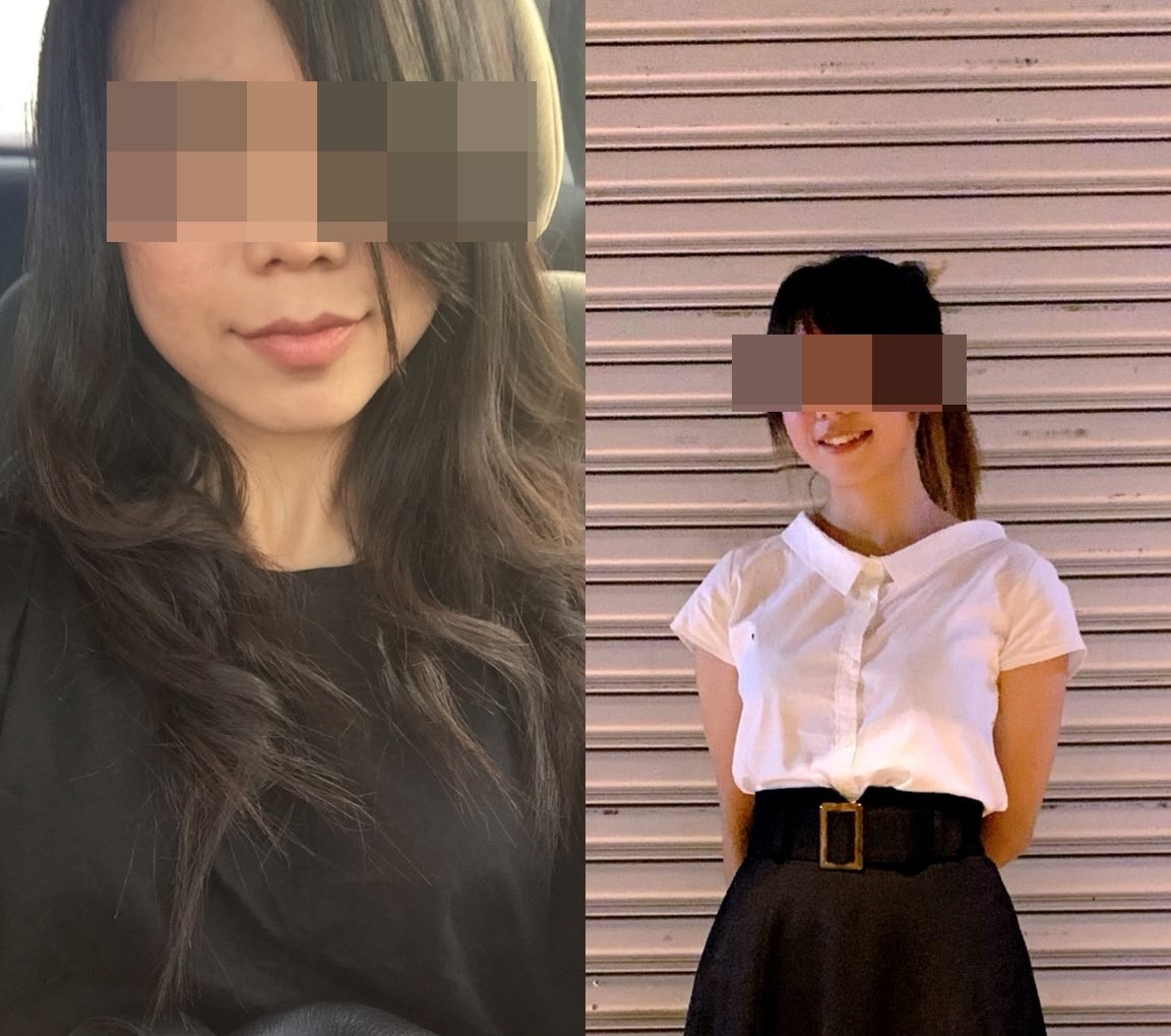 馬來西亞一名年輕女子懷孕後，竟臉上開始長滿痘痘，皮膚鬆垮，宛如老婦人。（翻攝X@ayyitslala）