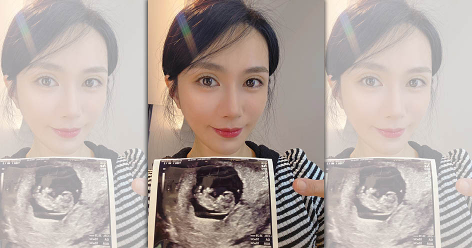 許鈞鈞曬超音波照宣布即將升格當媽。（翻攝自許鈞鈞臉書）